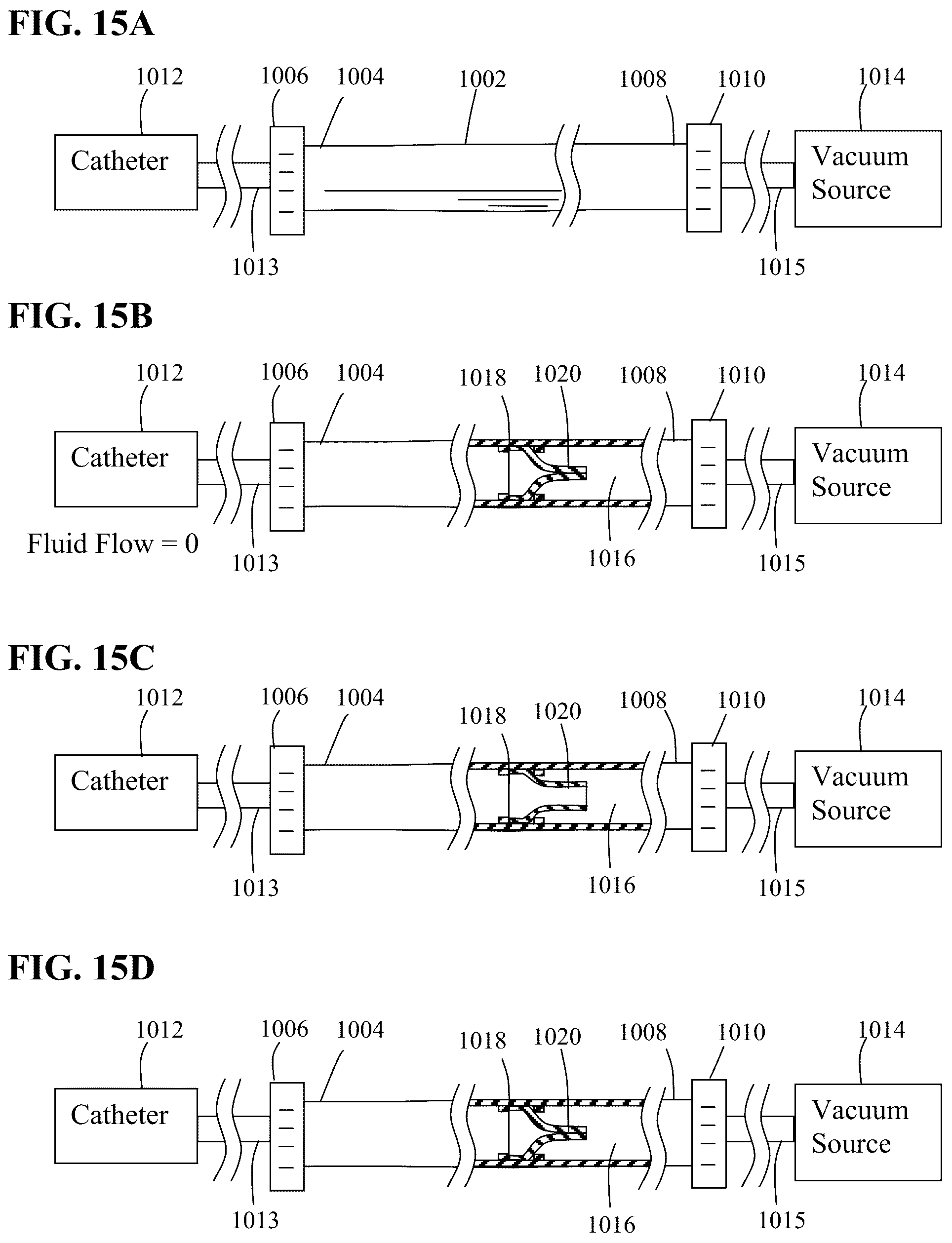 Patent US12318098 Figure 13 – Aspiration systems, devices and methods for treating ischemic stroke
