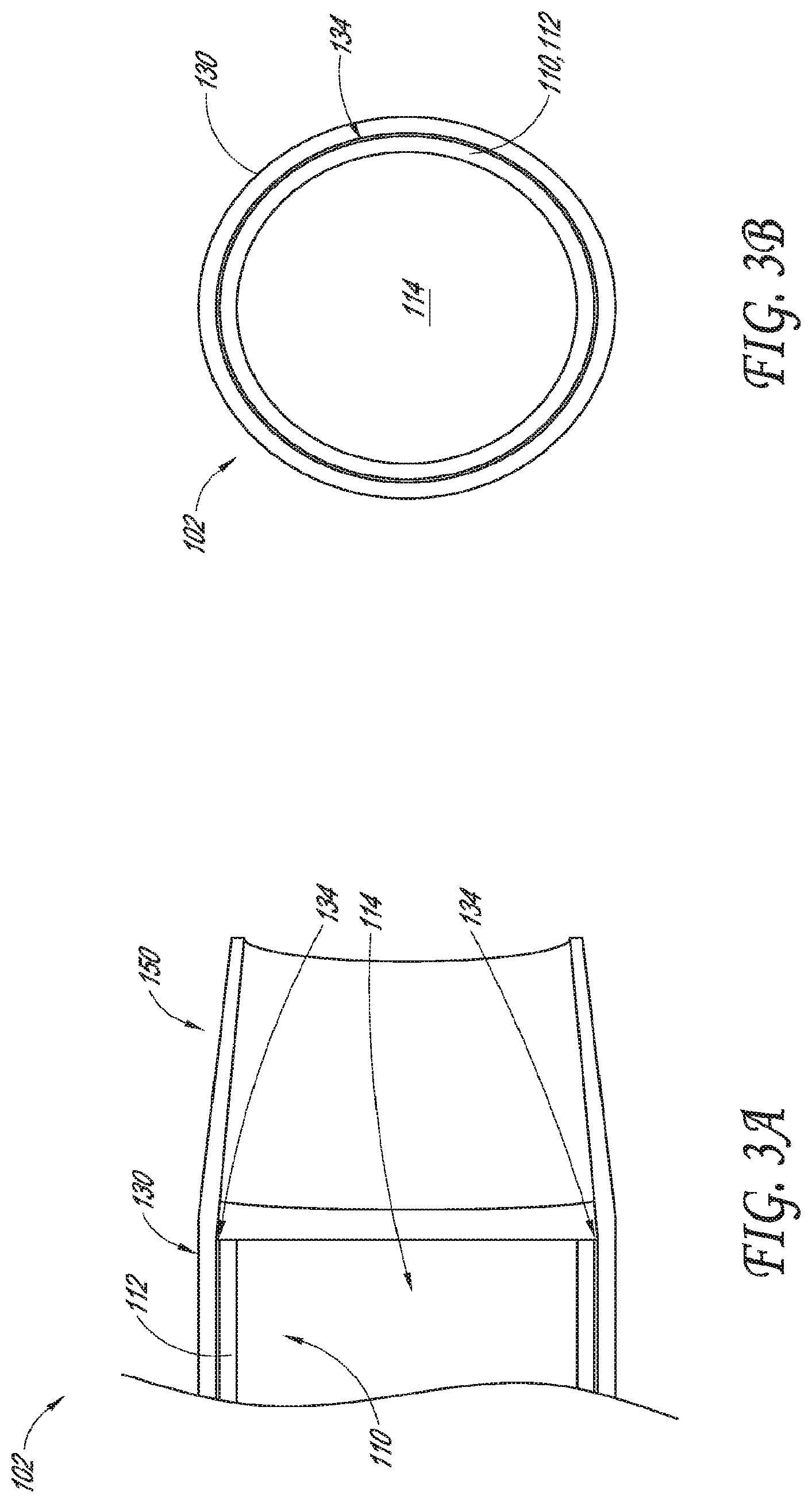Patent US12318099 Figure 4 – Devices and methods for minimally invasive kidney stone removal by combined aspiration and irrigation