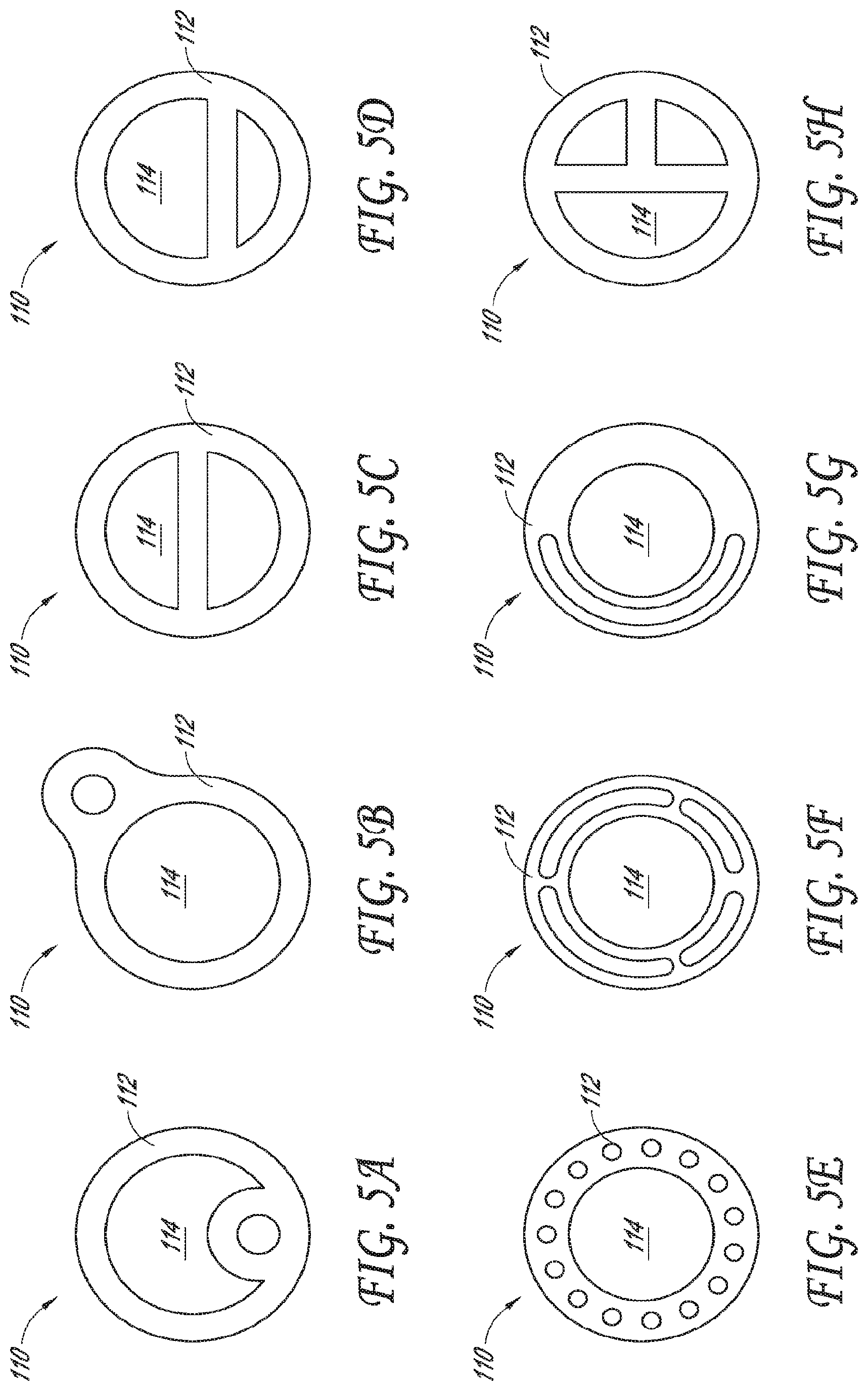 Patent US12318099 Figure 6 – Devices and methods for minimally invasive kidney stone removal by combined aspiration and irrigation