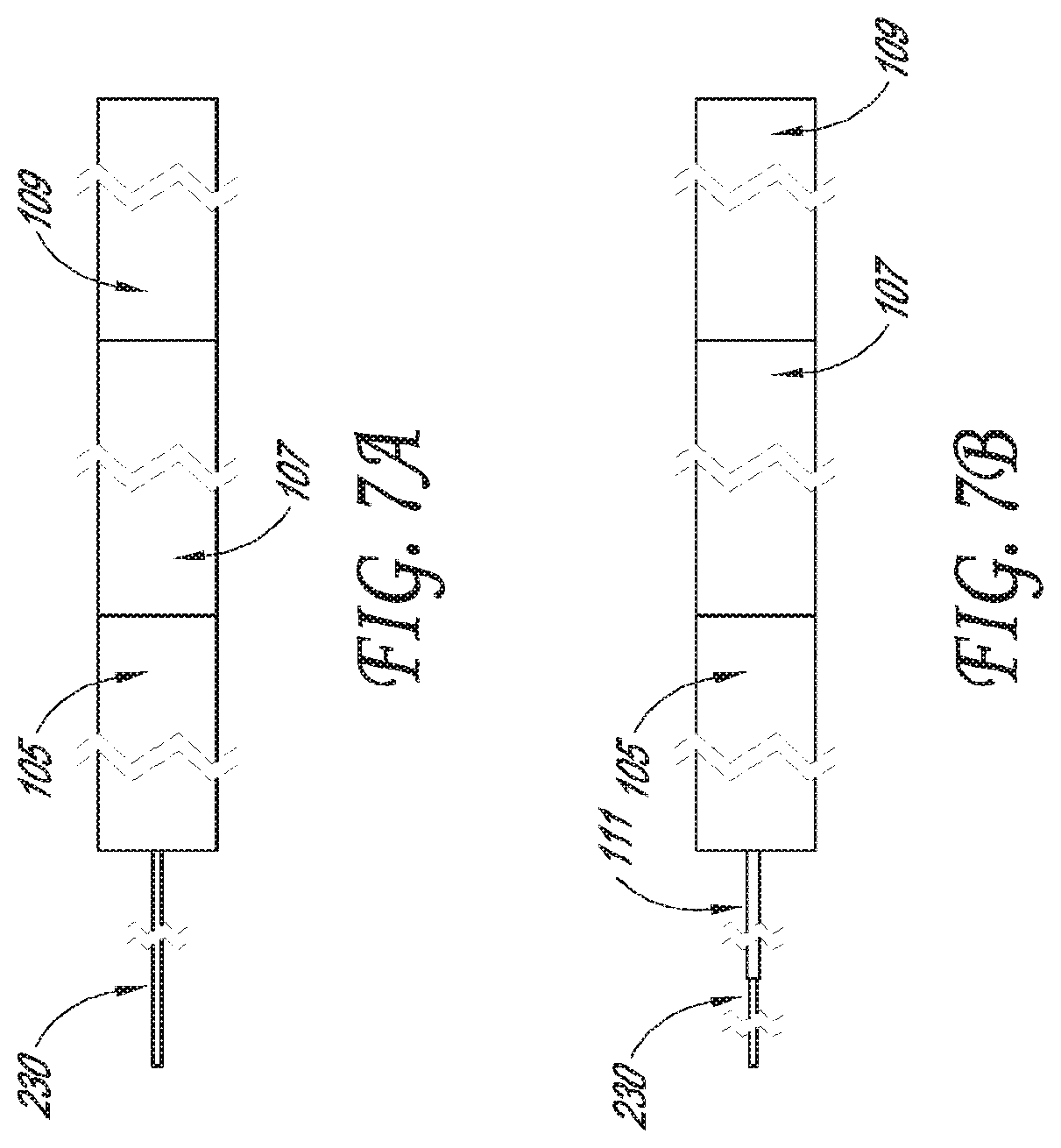 Patent US12318099 Figure 8 – Devices and methods for minimally invasive kidney stone removal by combined aspiration and irrigation