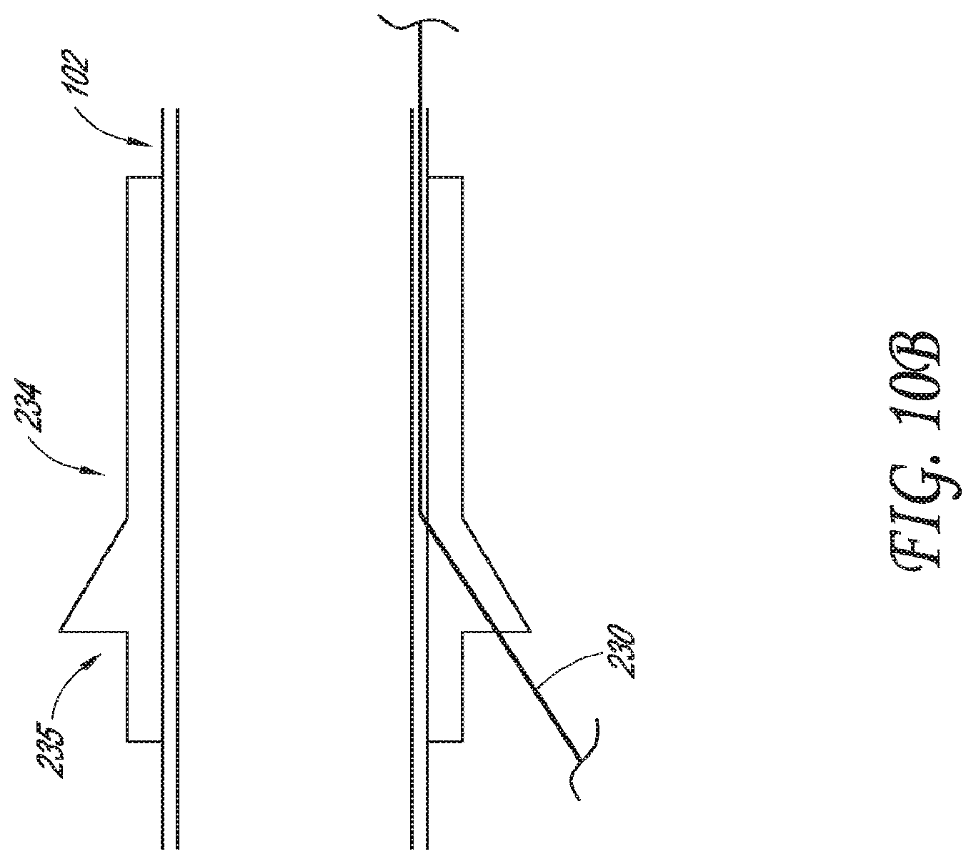 Patent US12318099 Figure 11 – Devices and methods for minimally invasive kidney stone removal by combined aspiration and irrigation