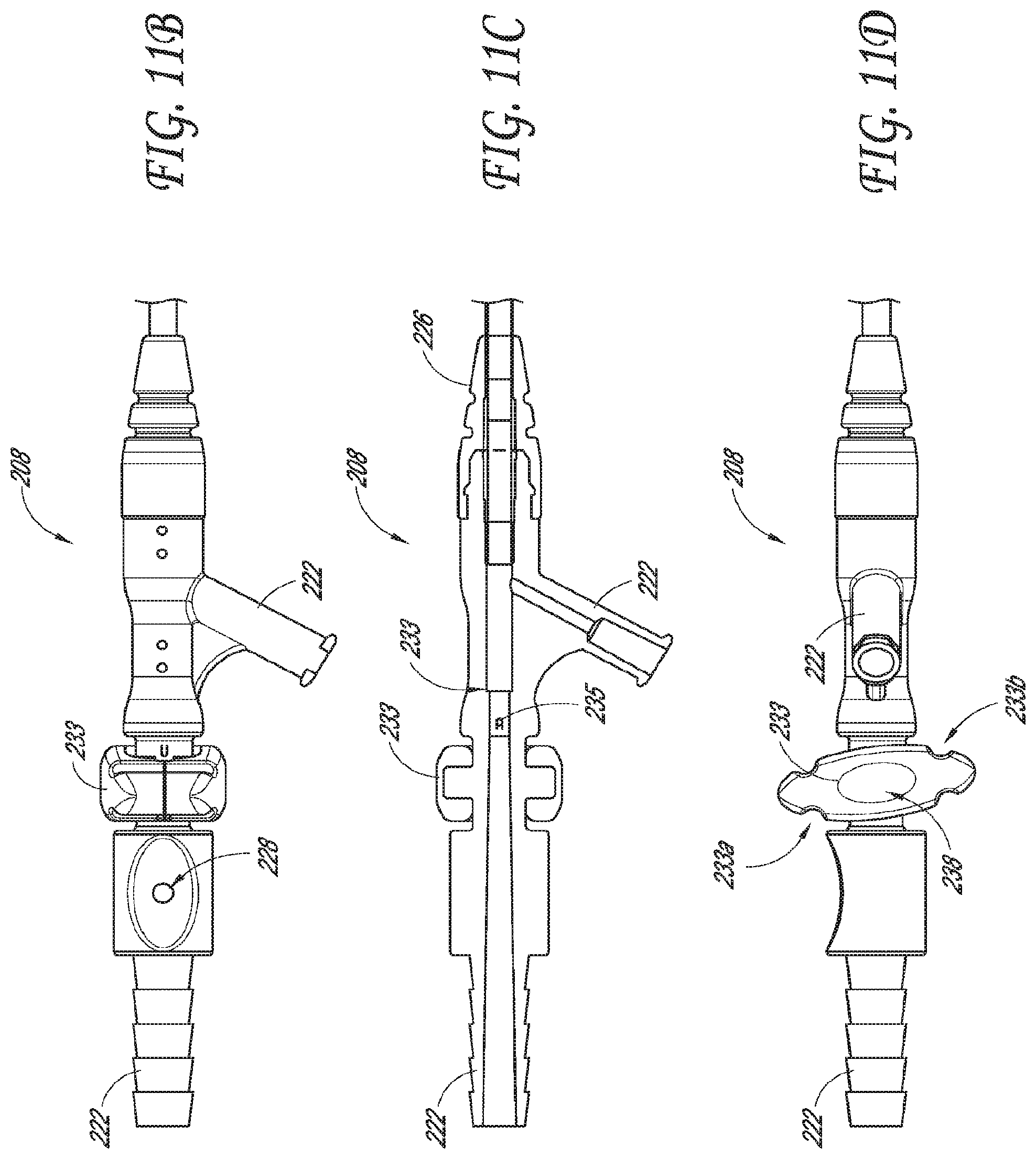 Patent US12318099 Figure 13 – Devices and methods for minimally invasive kidney stone removal by combined aspiration and irrigation