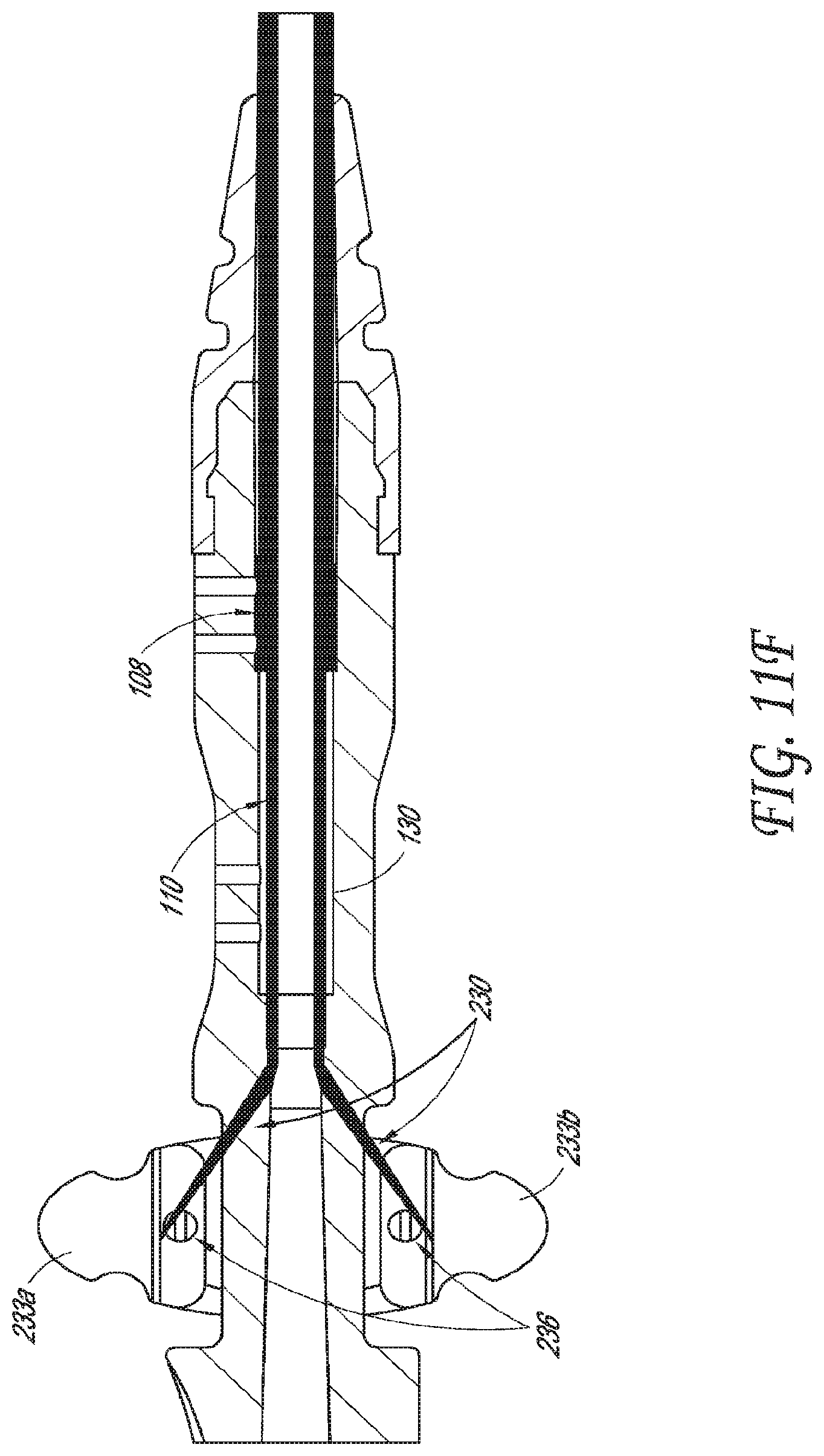 Patent US12318099 Figure 15 – Devices and methods for minimally invasive kidney stone removal by combined aspiration and irrigation