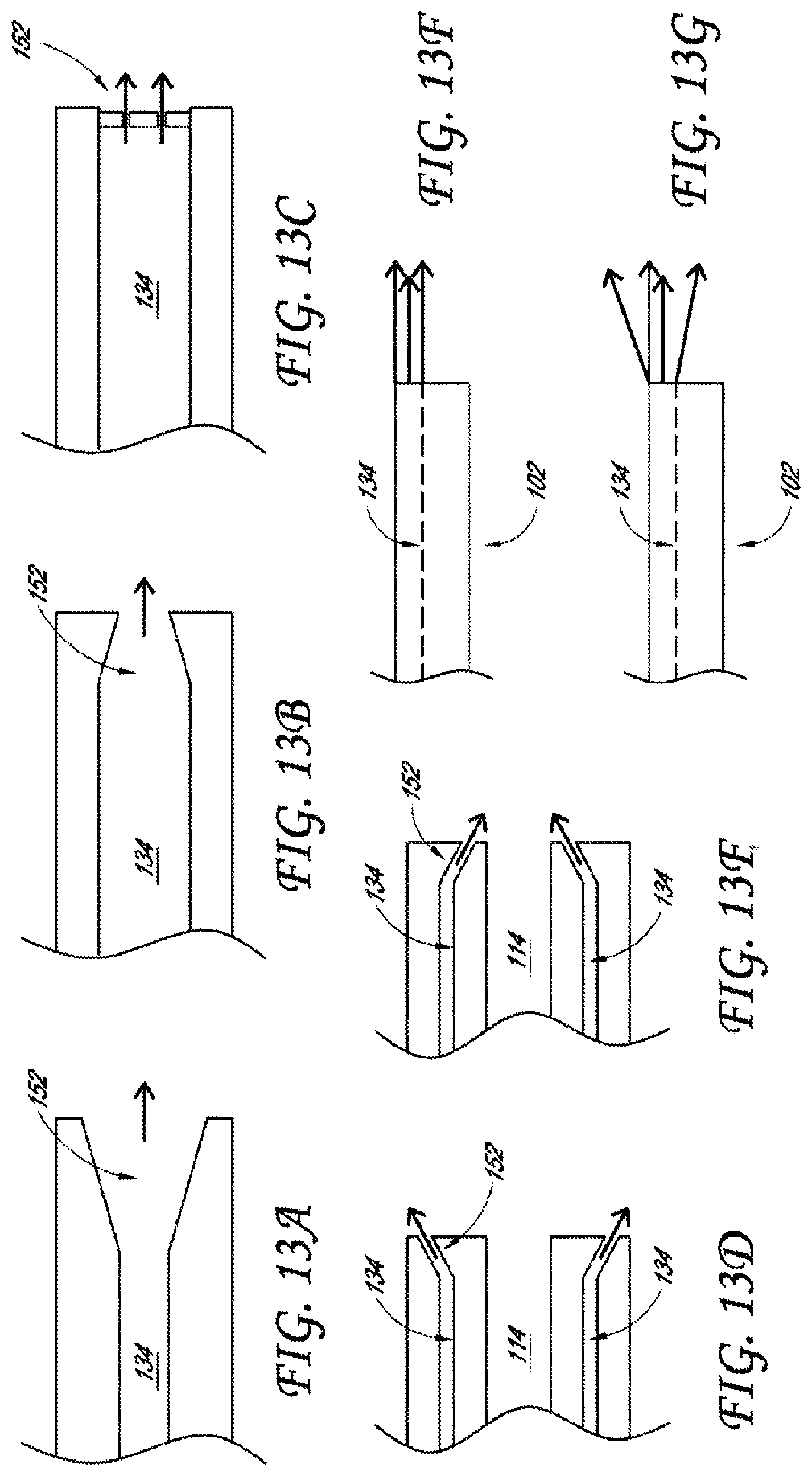 Patent US12318099 Figure 16 – Devices and methods for minimally invasive kidney stone removal by combined aspiration and irrigation