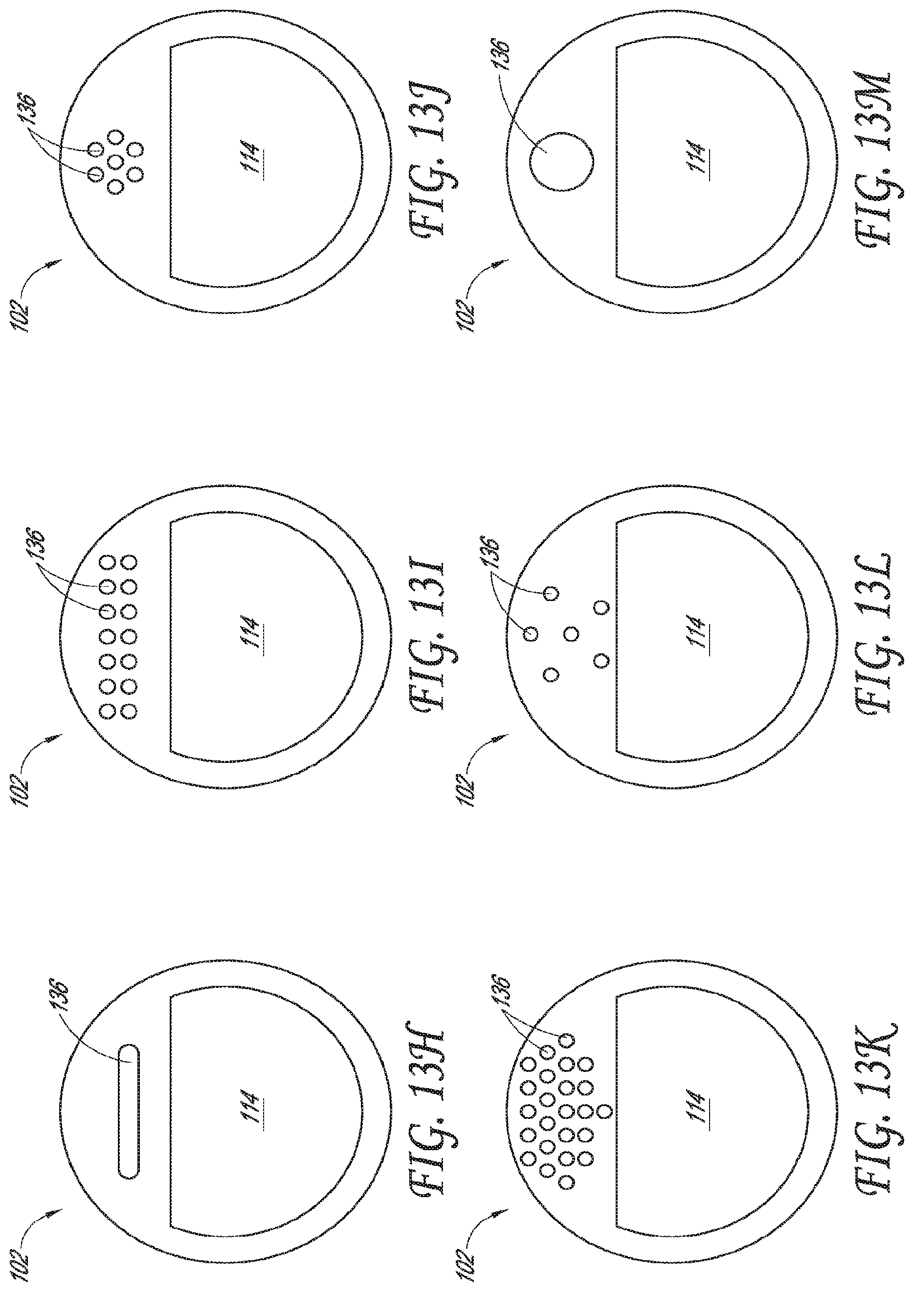 Patent US12318099 Figure 17 – Devices and methods for minimally invasive kidney stone removal by combined aspiration and irrigation