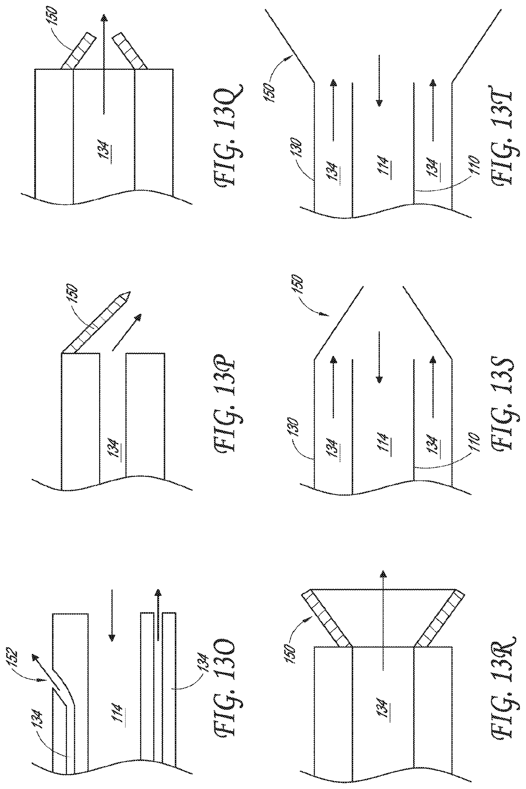 Patent US12318099 Figure 19 – Devices and methods for minimally invasive kidney stone removal by combined aspiration and irrigation