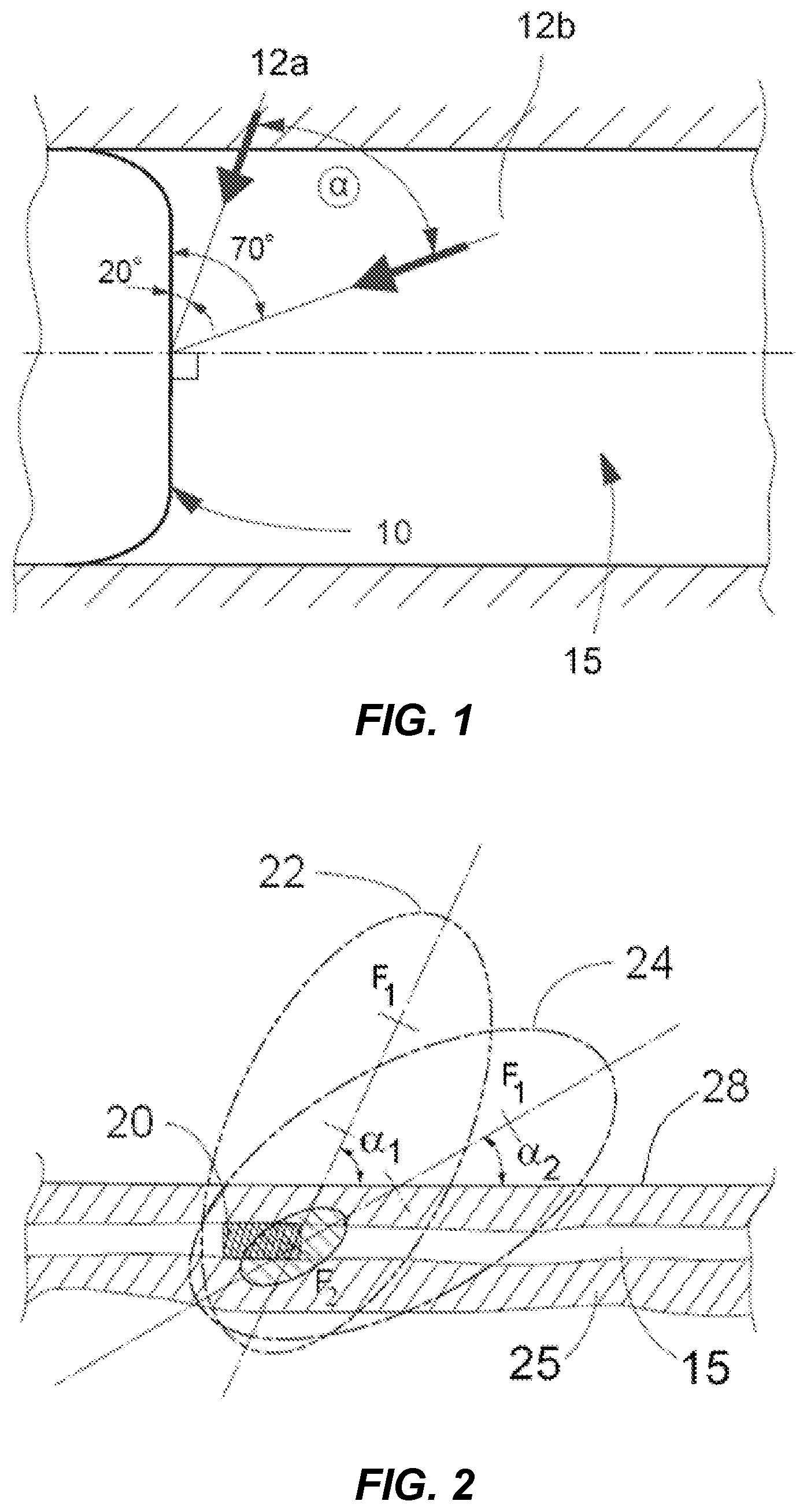 Patent US12318100 — Shock wave vessel catheter system and method — Figure 1