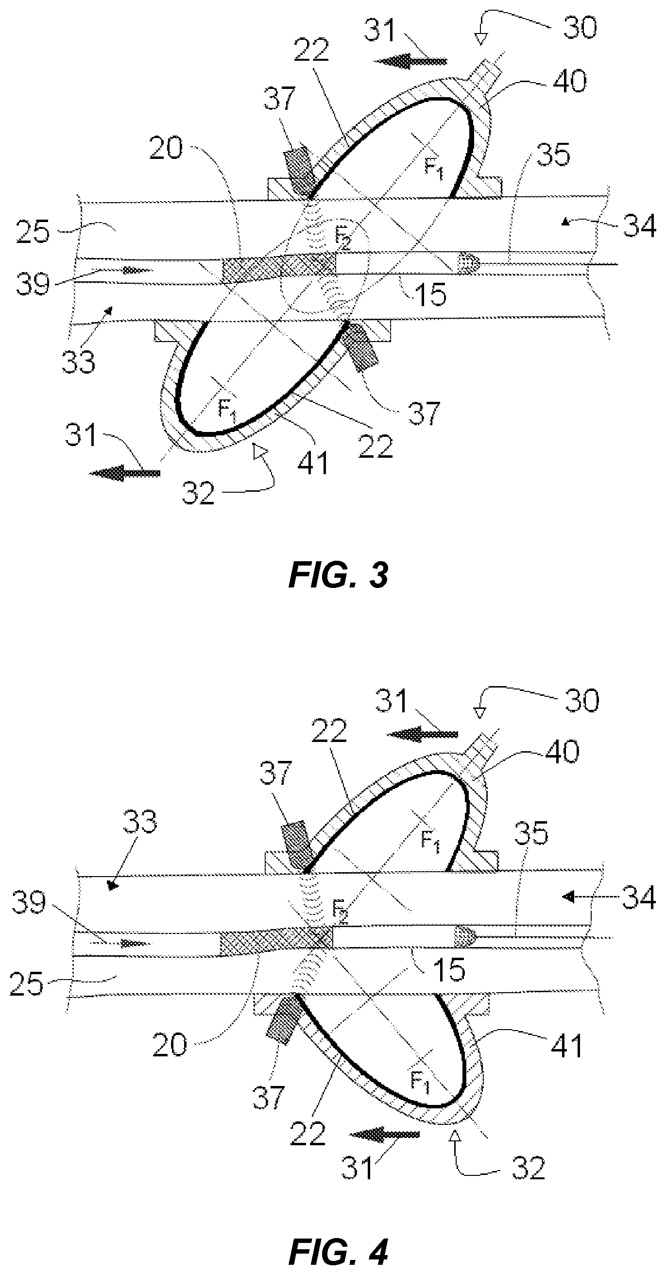 Patent US12318100 Figure 2 – Shock wave vessel catheter system and method