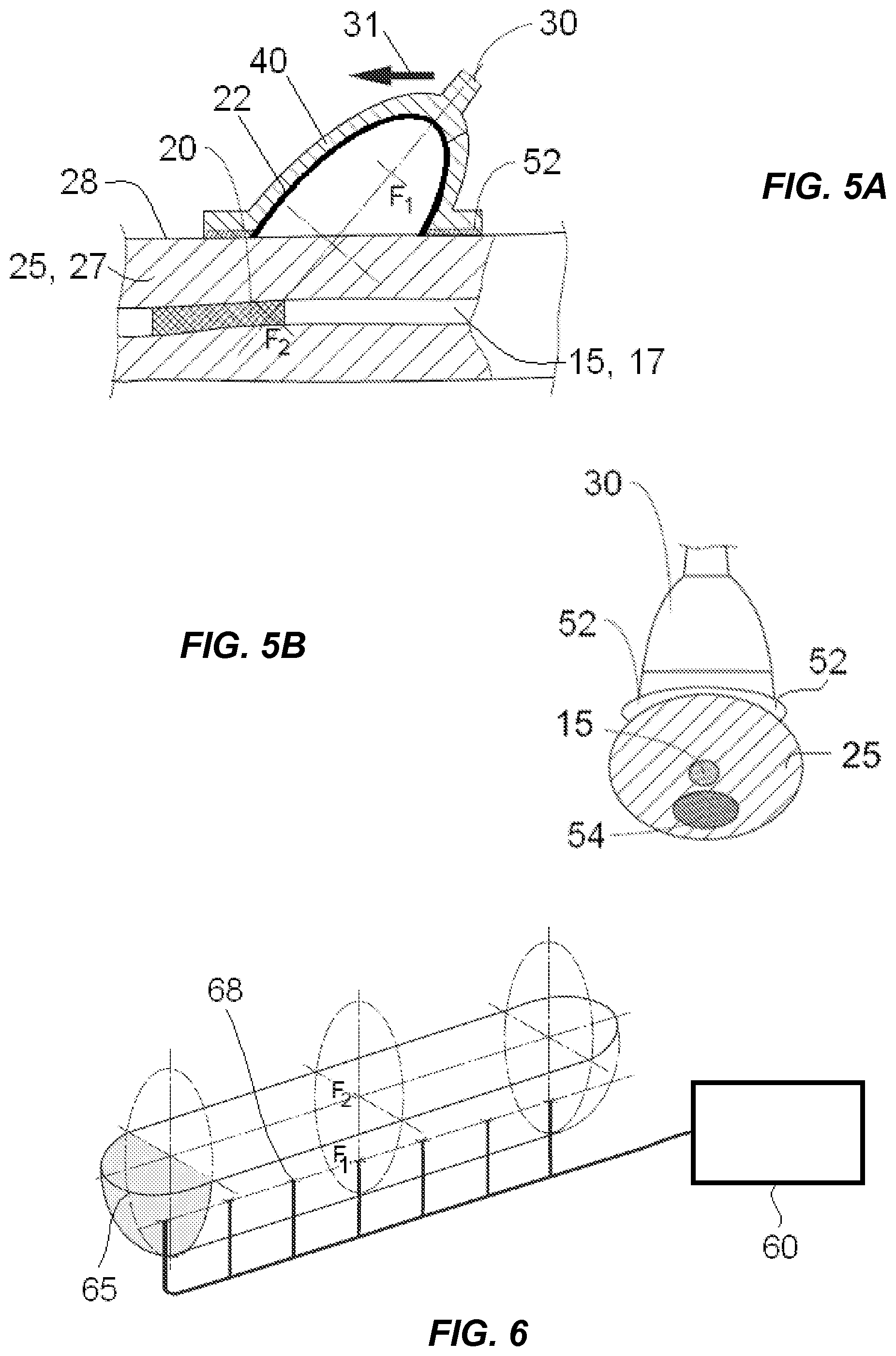 Patent US12318100 Figure 3 – Shock wave vessel catheter system and method