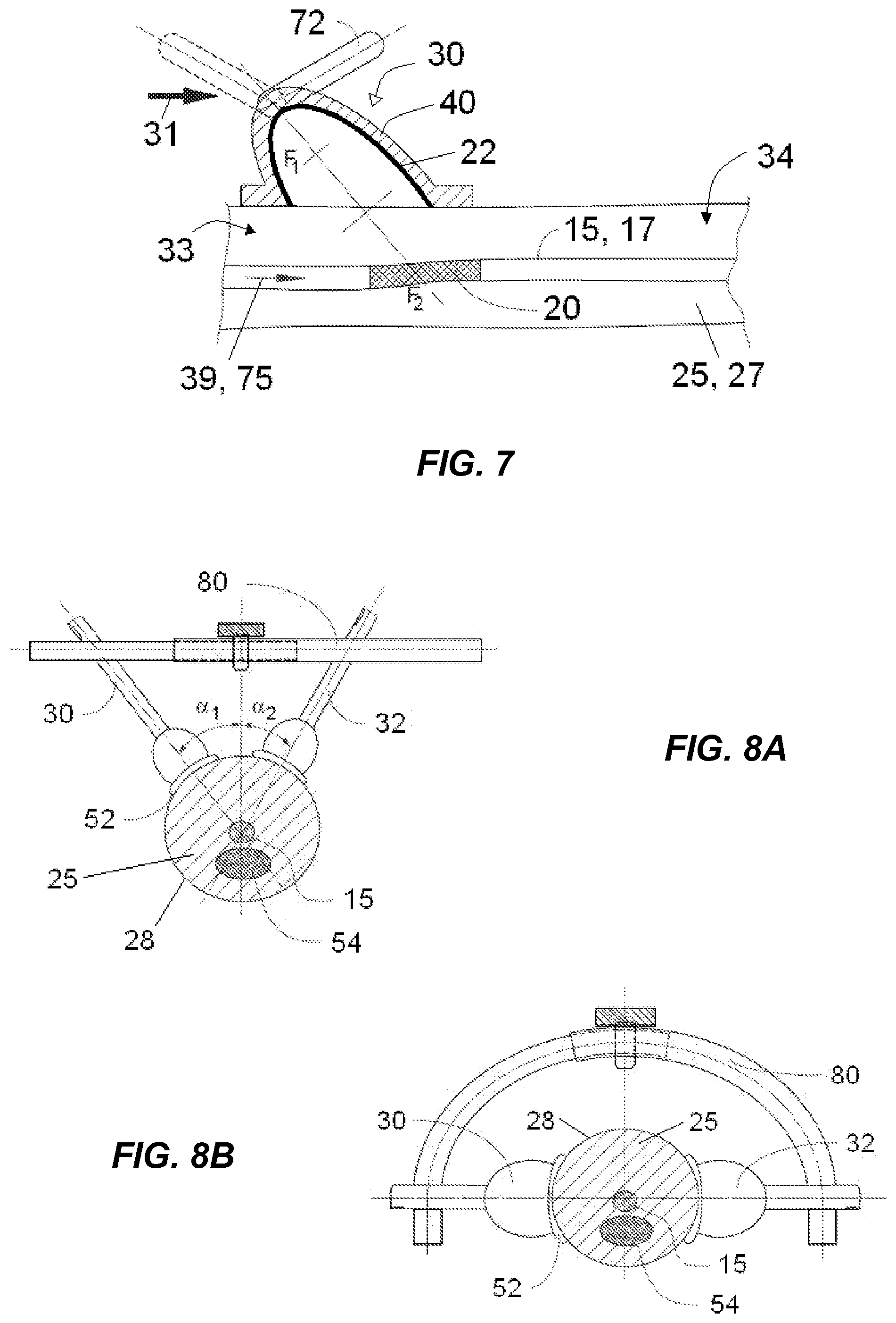 Patent US12318100 Figure 4 – Shock wave vessel catheter system and method