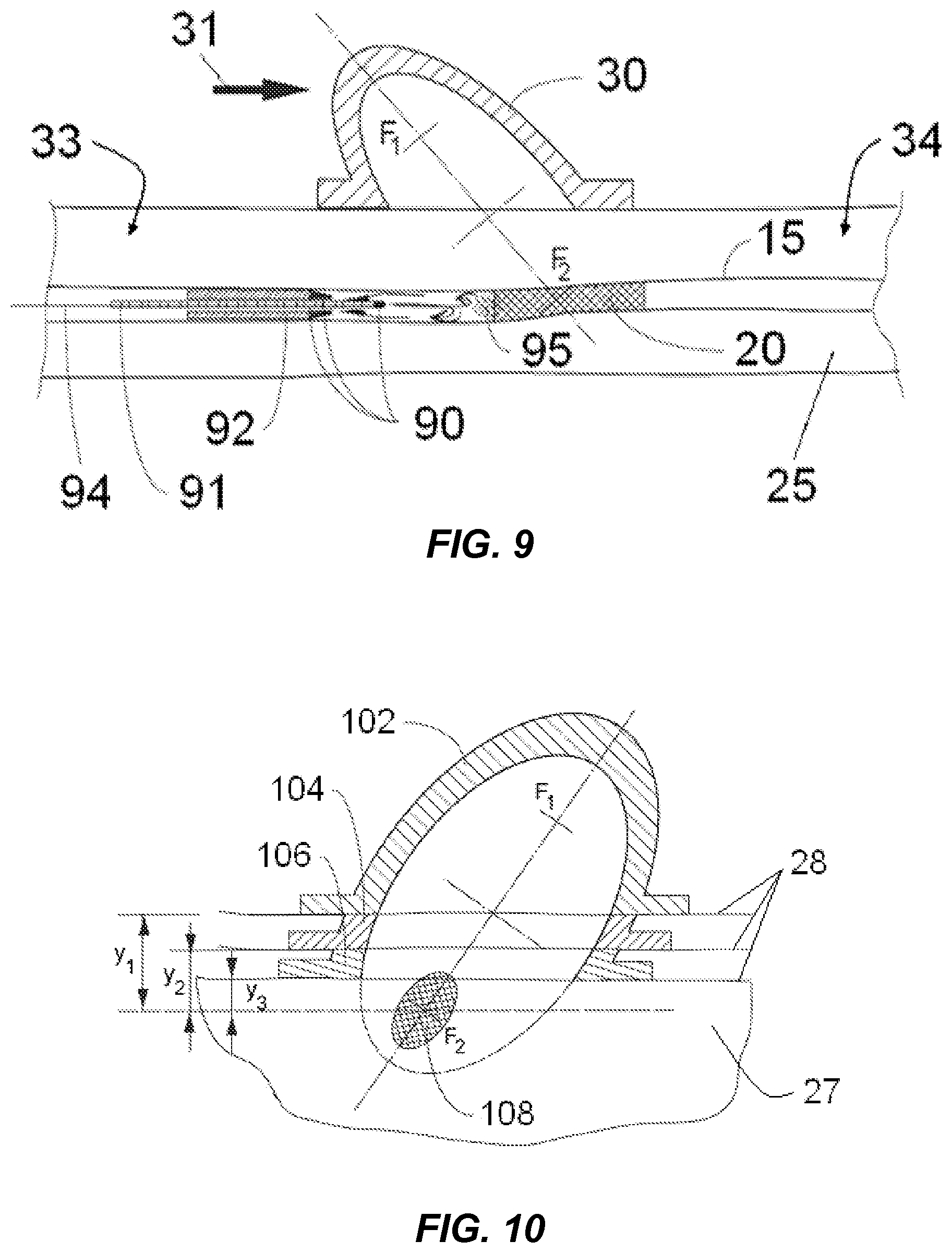 Patent US12318100 Figure 5 – Shock wave vessel catheter system and method