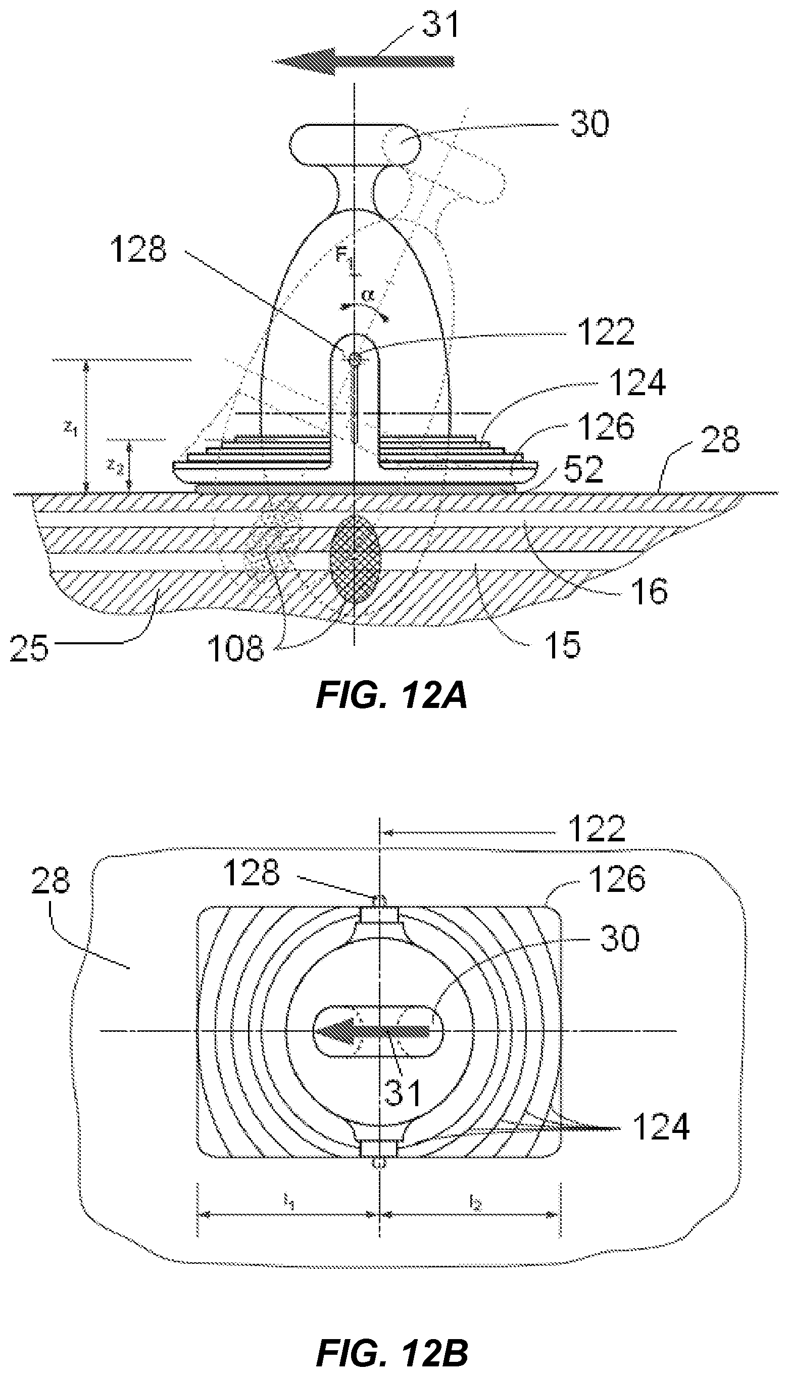 Patent US12318100 Figure 7 – Shock wave vessel catheter system and method