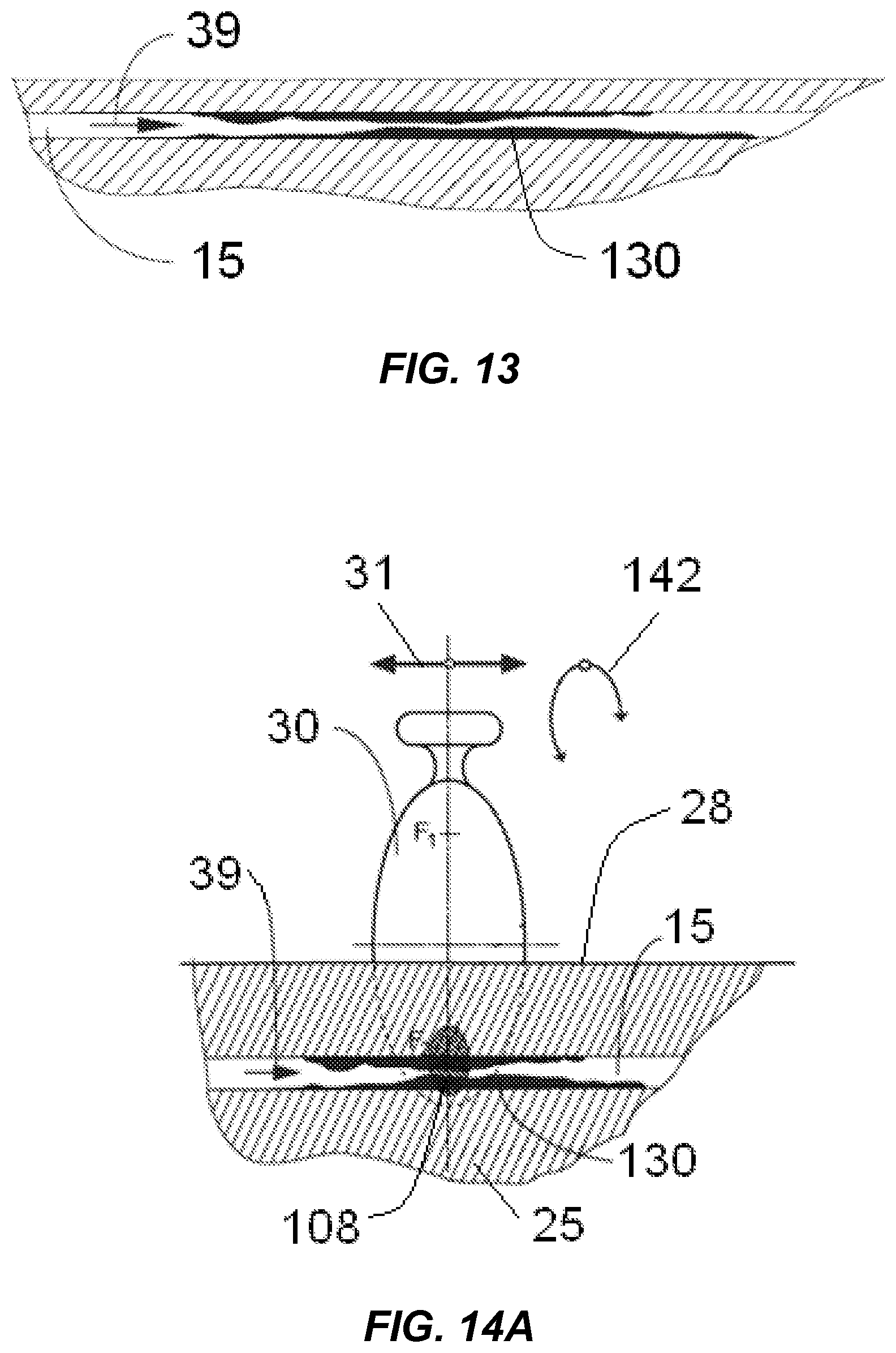 Patent US12318100 Figure 8 – Shock wave vessel catheter system and method