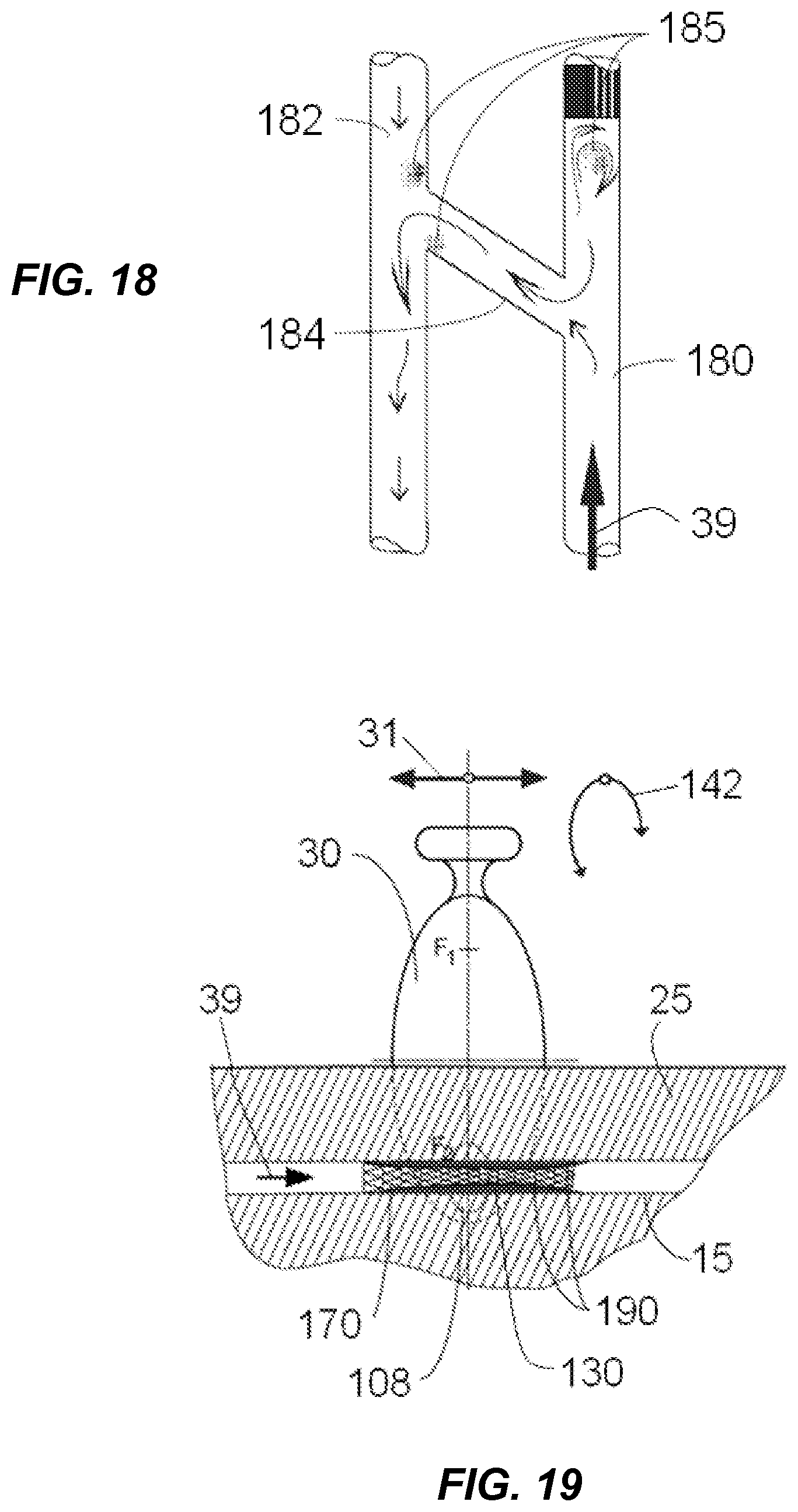 Patent US12318100 Figure 12 – Shock wave vessel catheter system and method