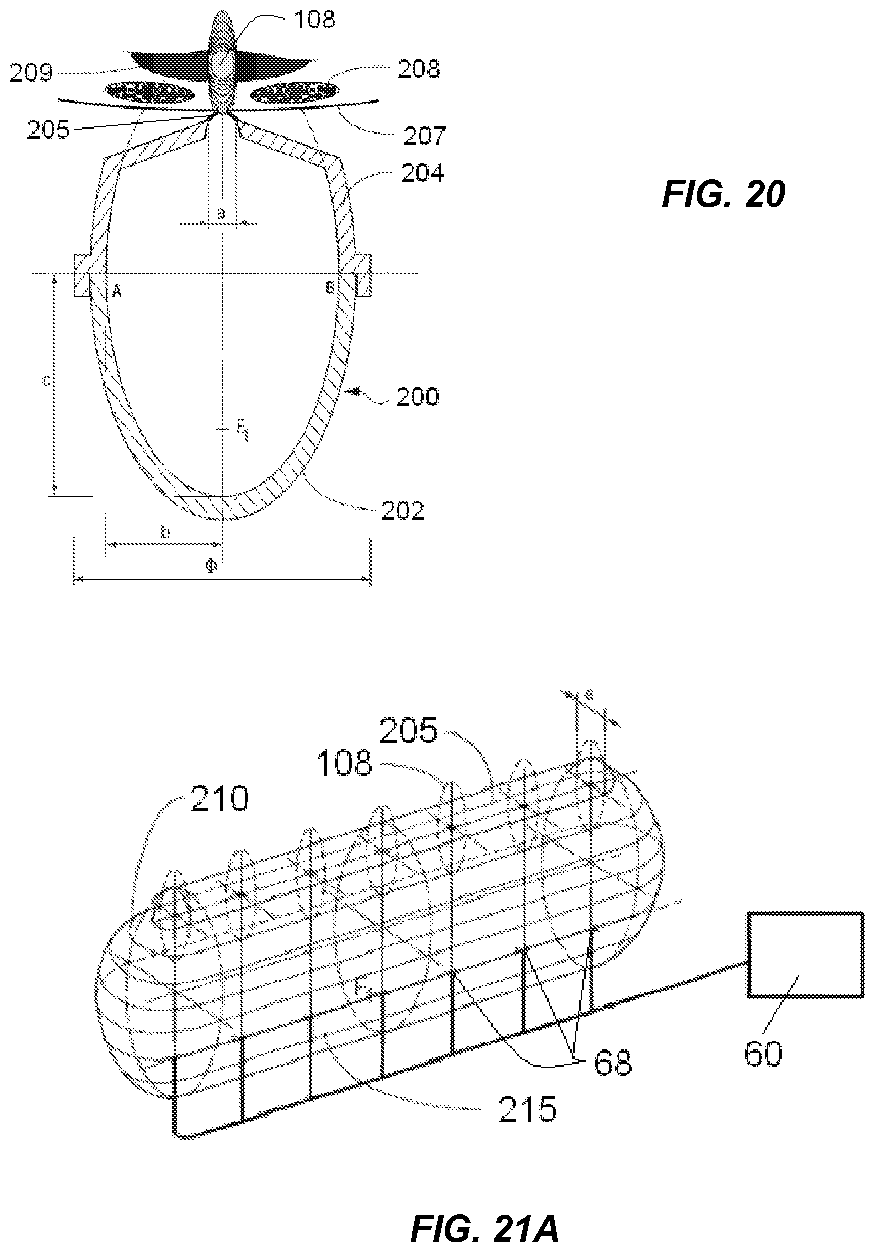 Patent US12318100 Figure 13 – Shock wave vessel catheter system and method