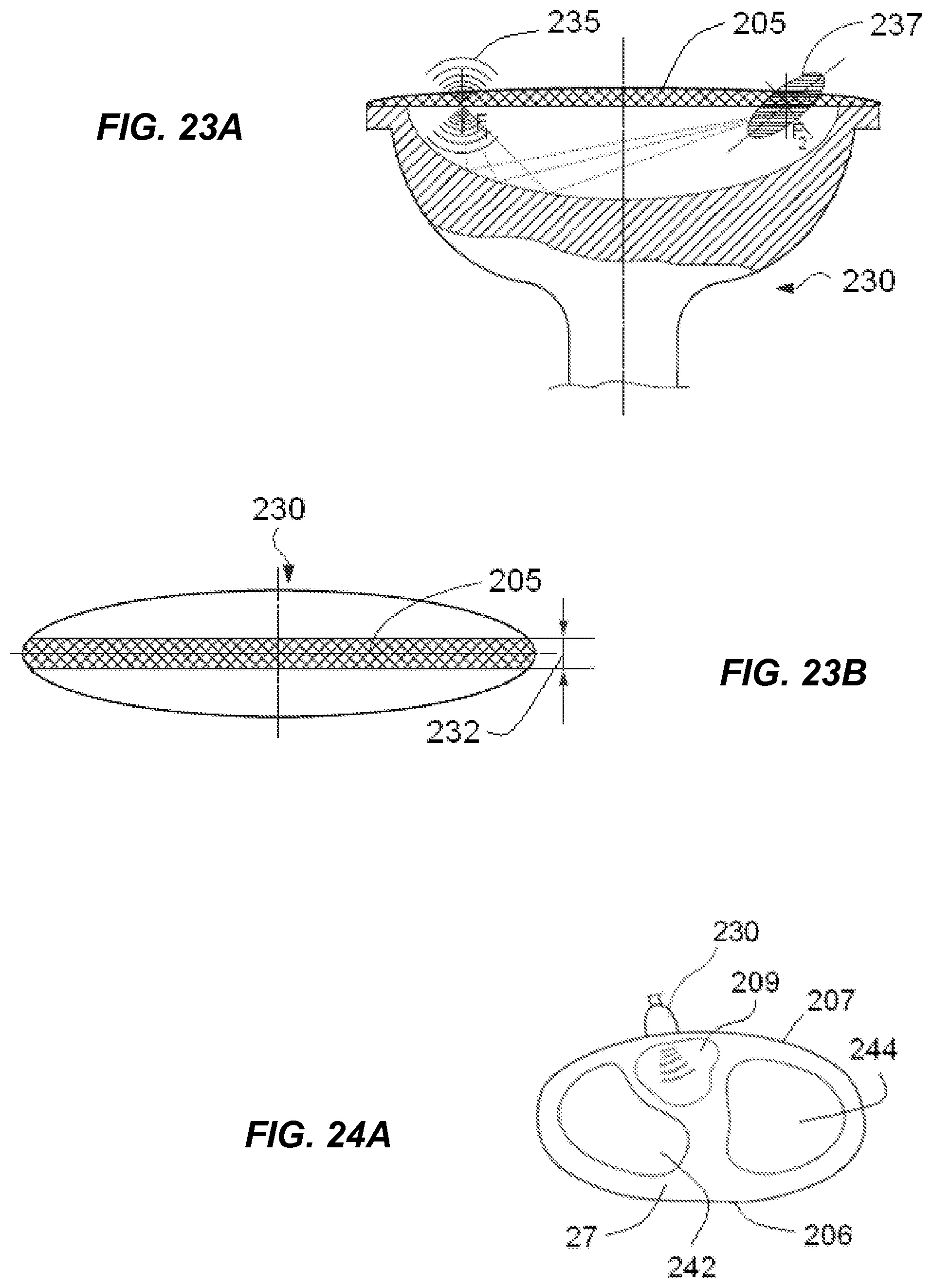 Patent US12318100 Figure 15 – Shock wave vessel catheter system and method