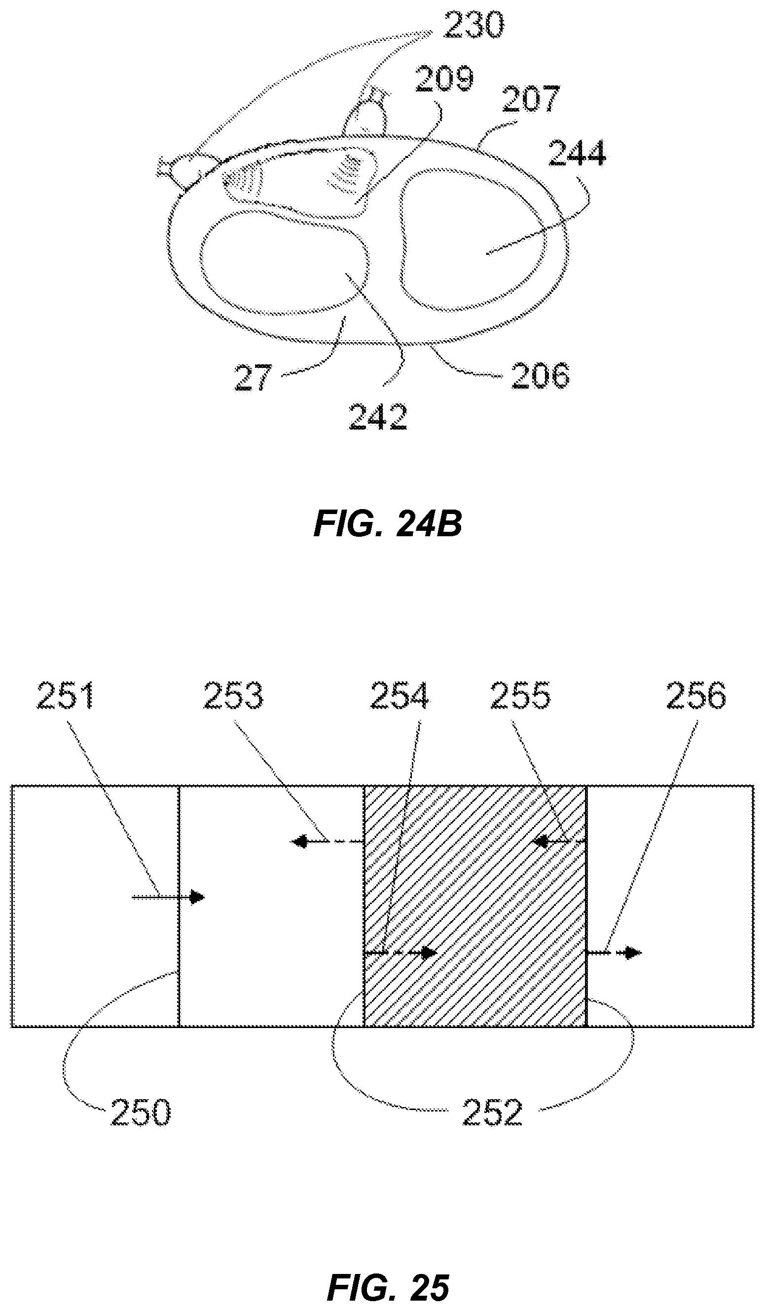 Patent US12318100 Figure 16 – Shock wave vessel catheter system and method