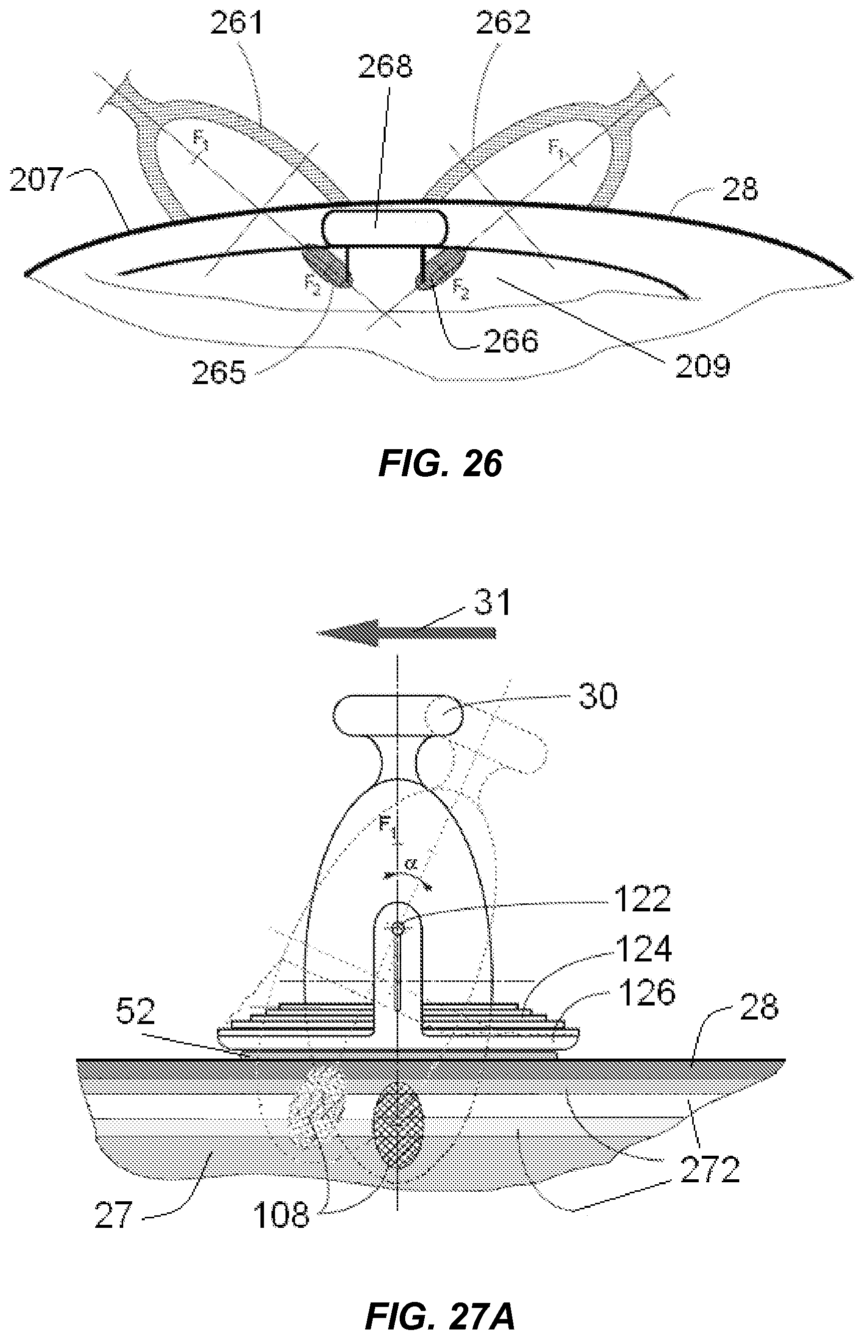 Patent US12318100 Figure 17 – Shock wave vessel catheter system and method