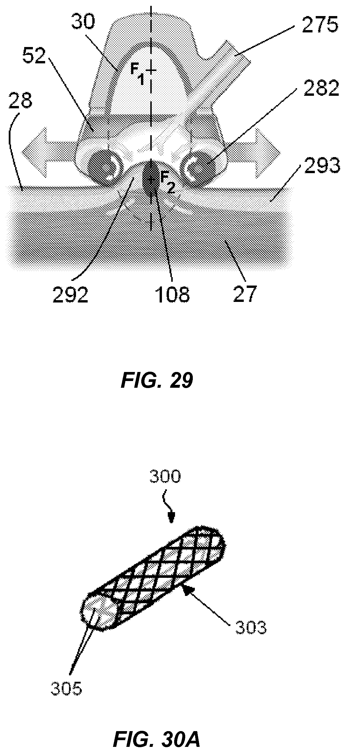 Patent US12318100 Figure 19 – Shock wave vessel catheter system and method