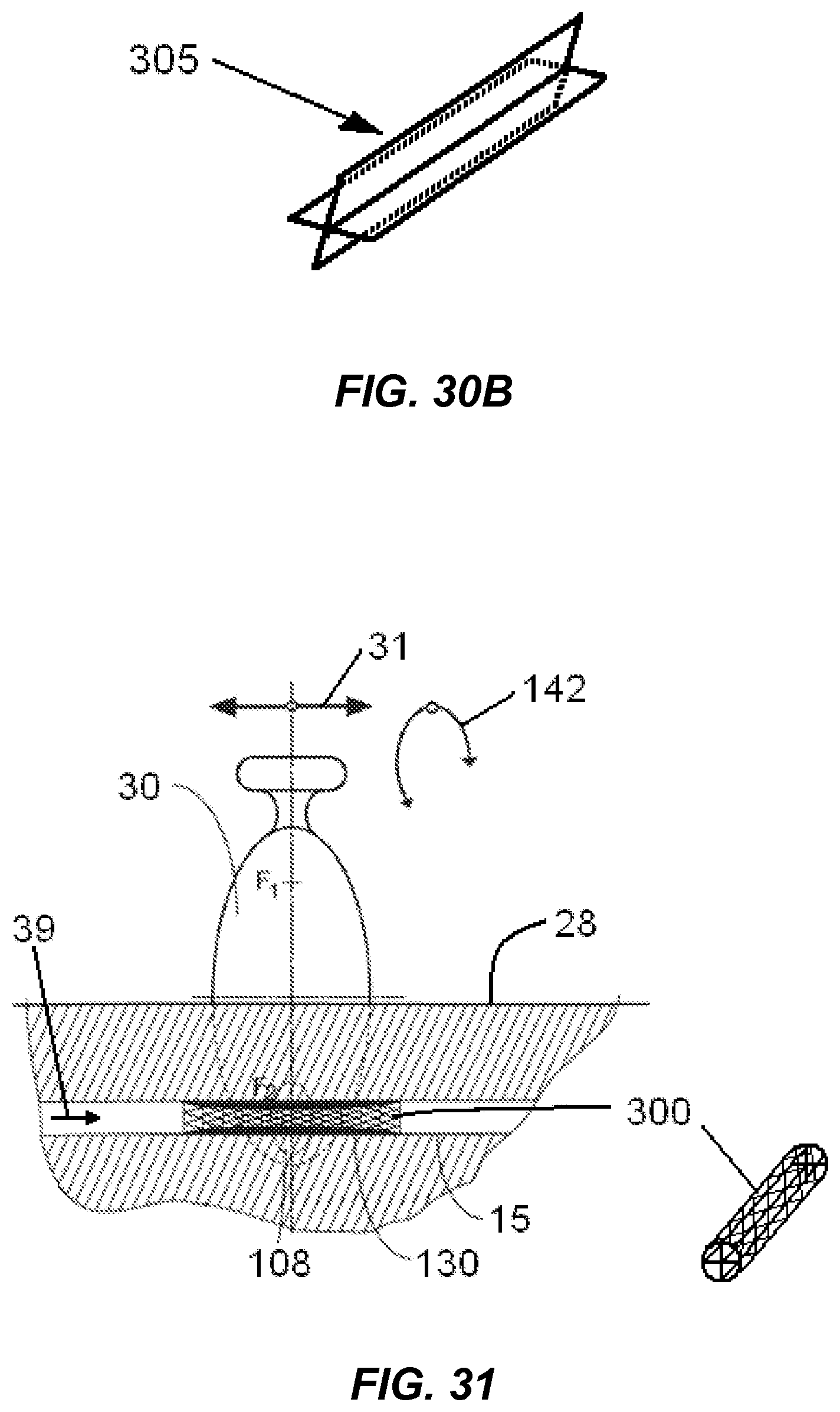 Patent US12318100 Figure 20 – Shock wave vessel catheter system and method