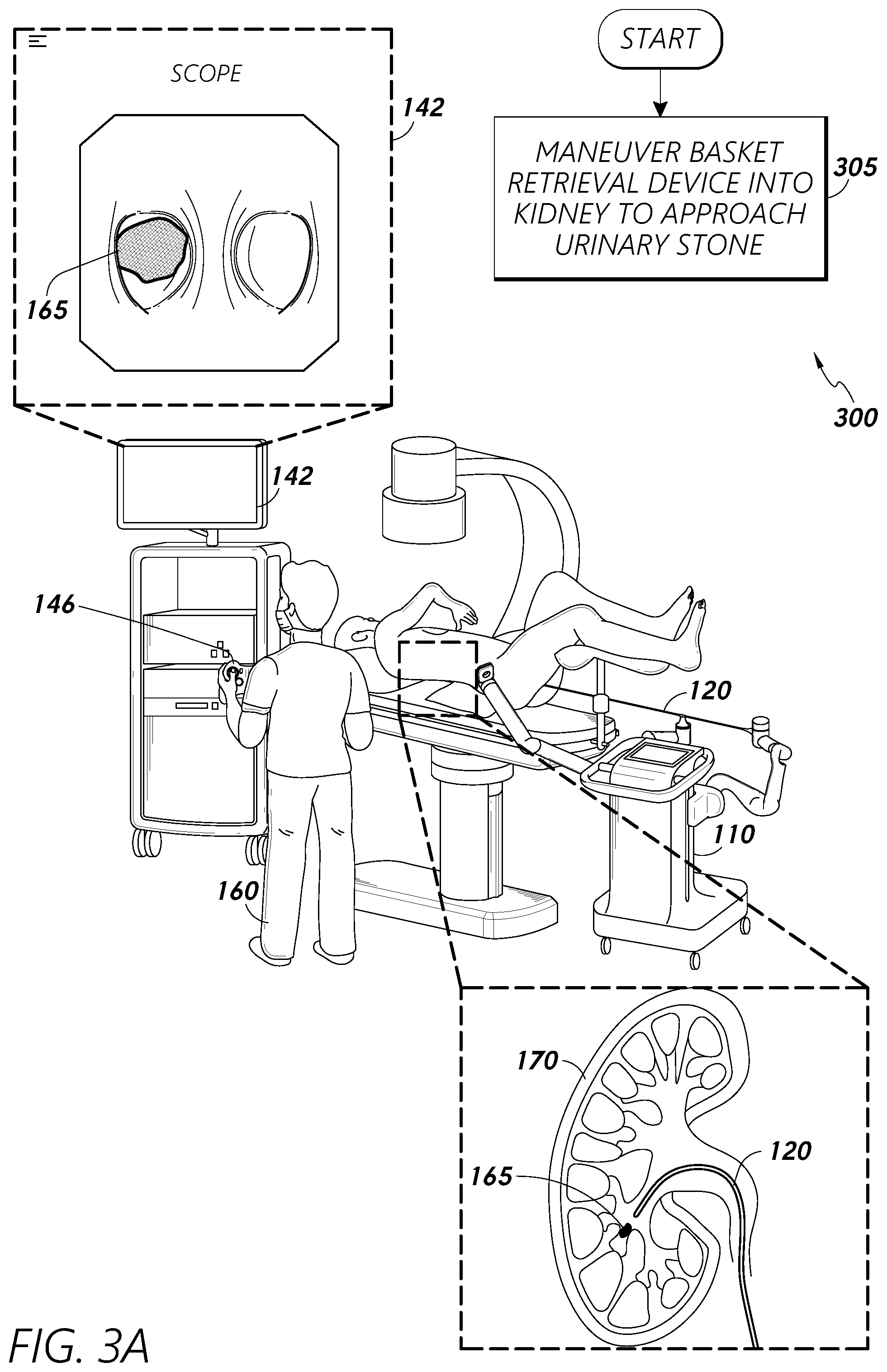Patent US12318102 Figure 3 – Advanced basket drive mode