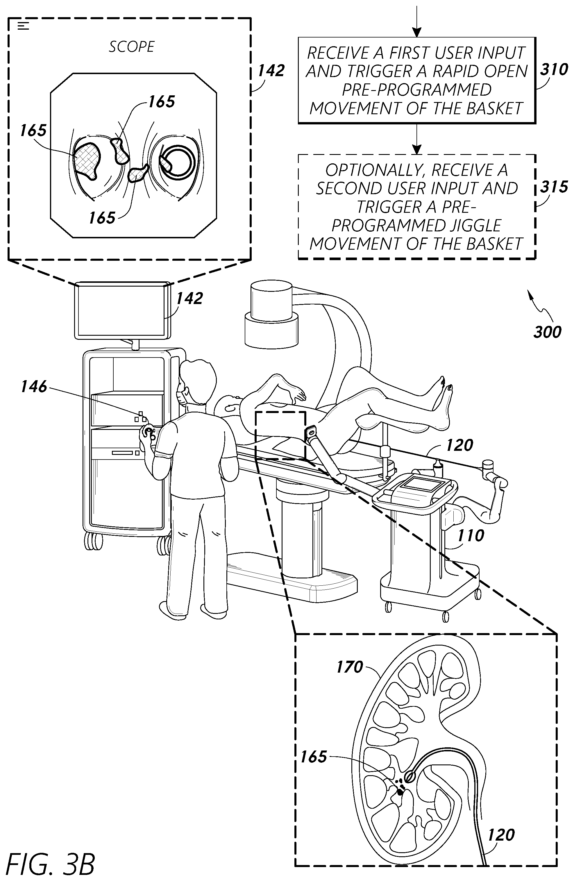 Patent US12318102 Figure 4 – Advanced basket drive mode