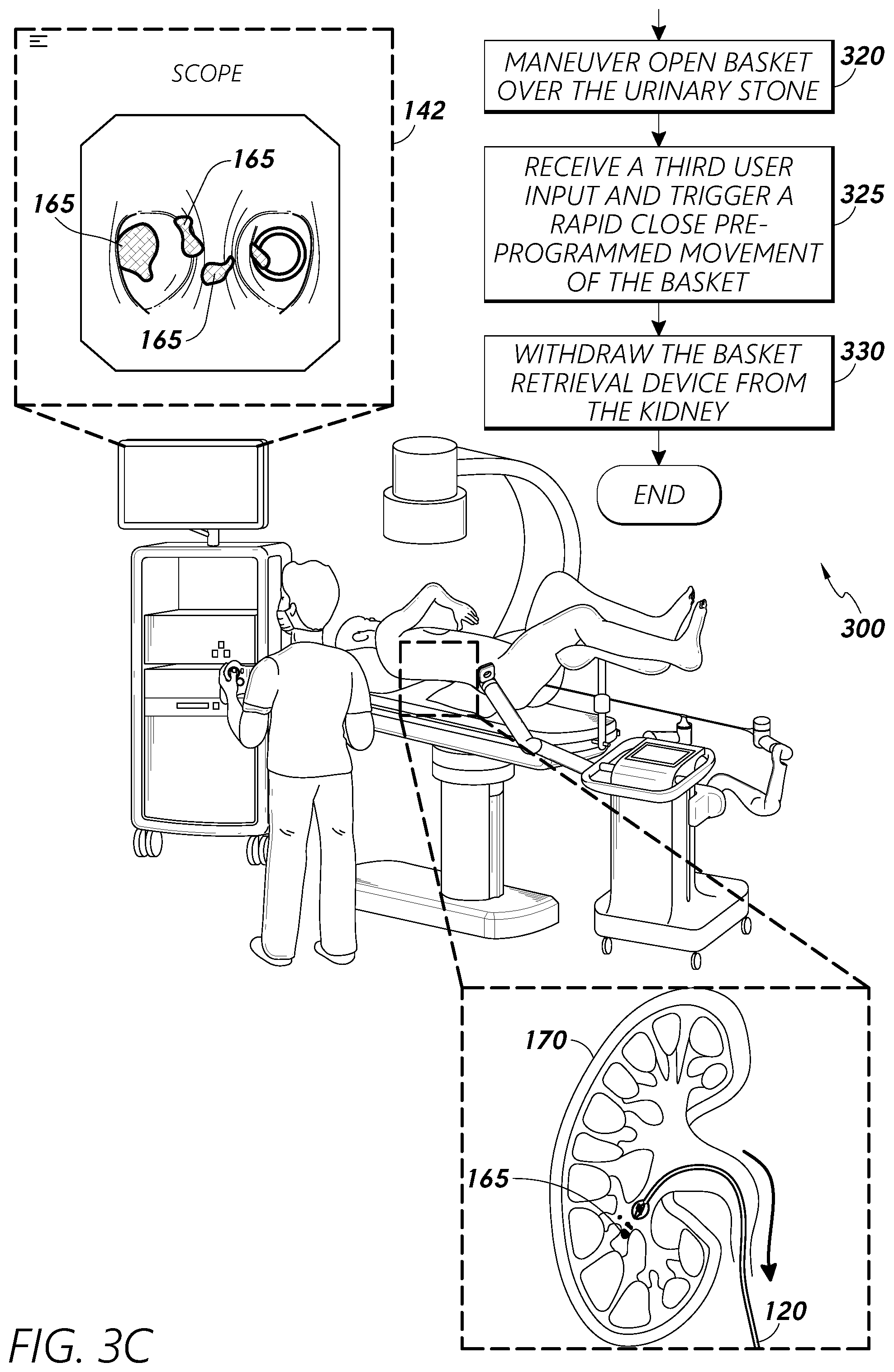 Patent US12318102 Figure 5 – Advanced basket drive mode