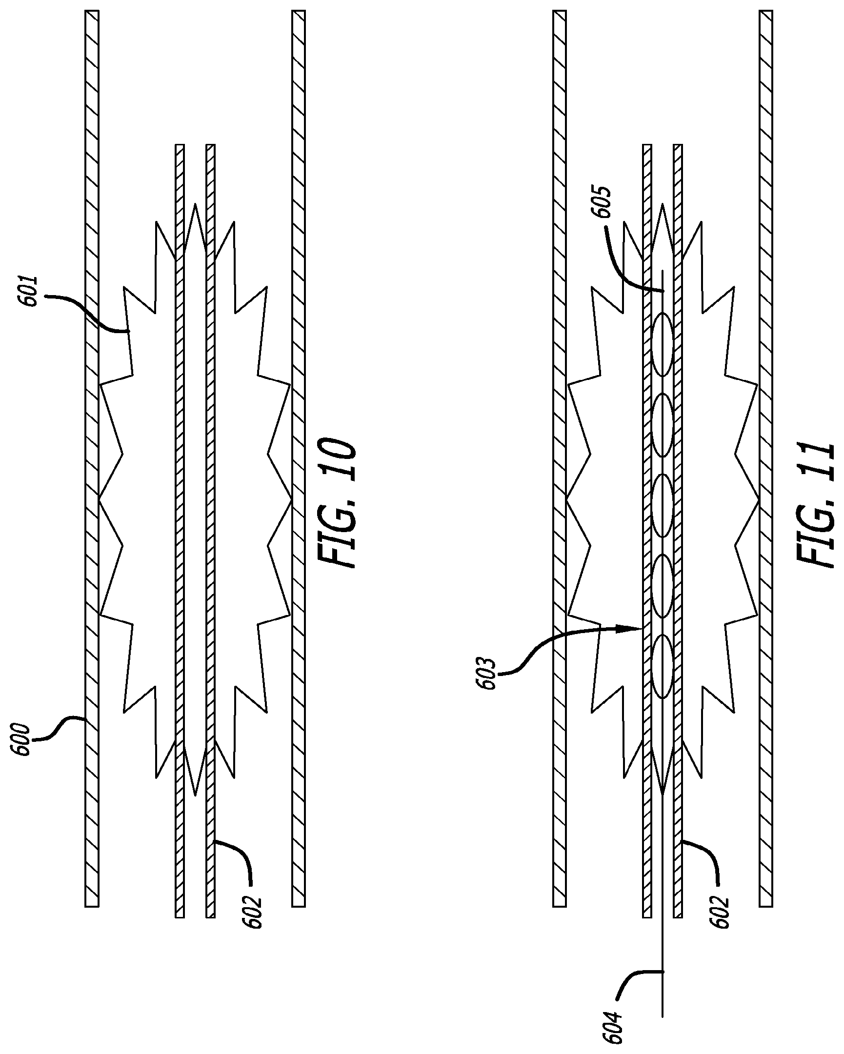 Patent US12318103 Figure 9 – Obstruction removal system