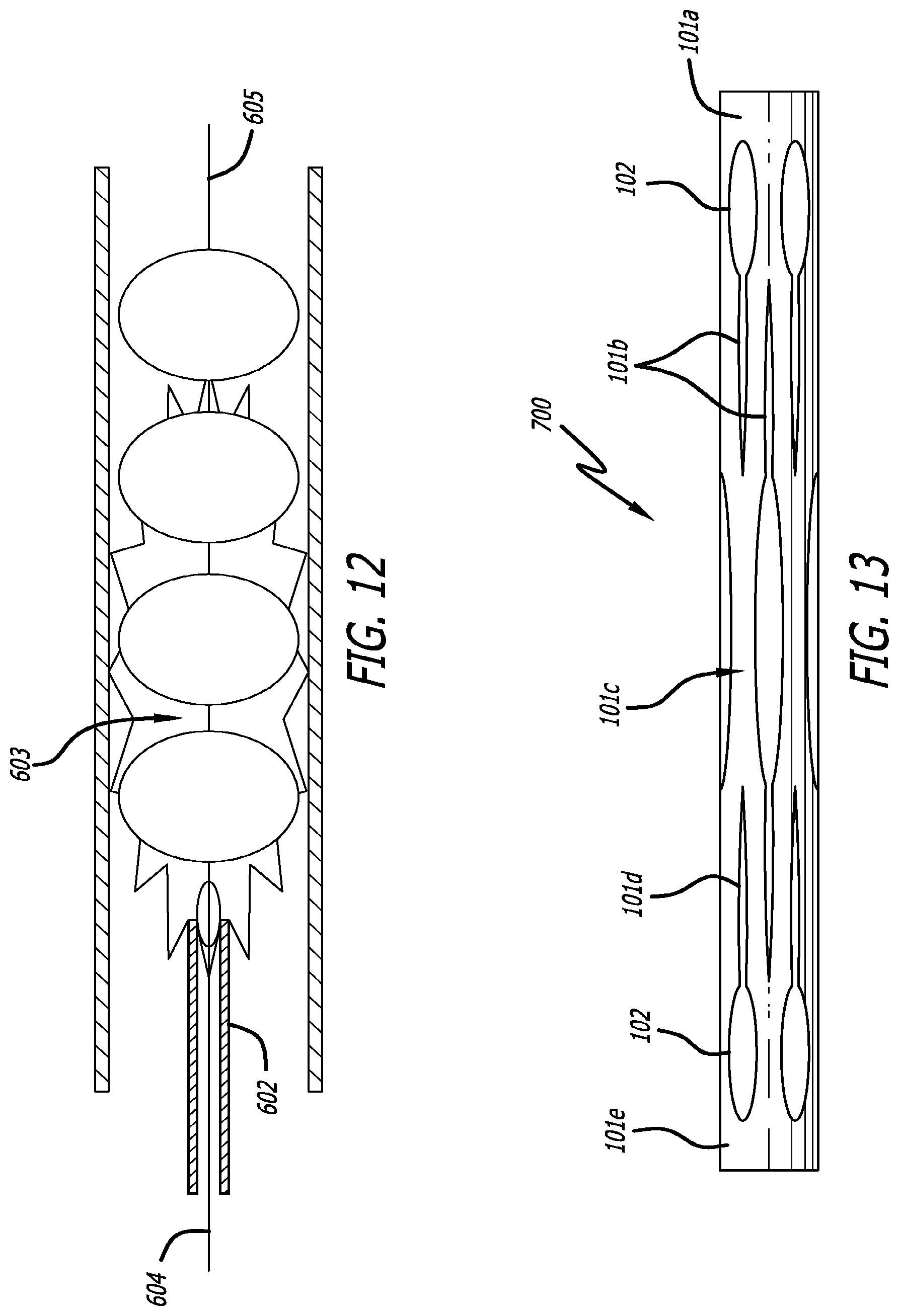 Patent US12318103 Figure 10 – Obstruction removal system