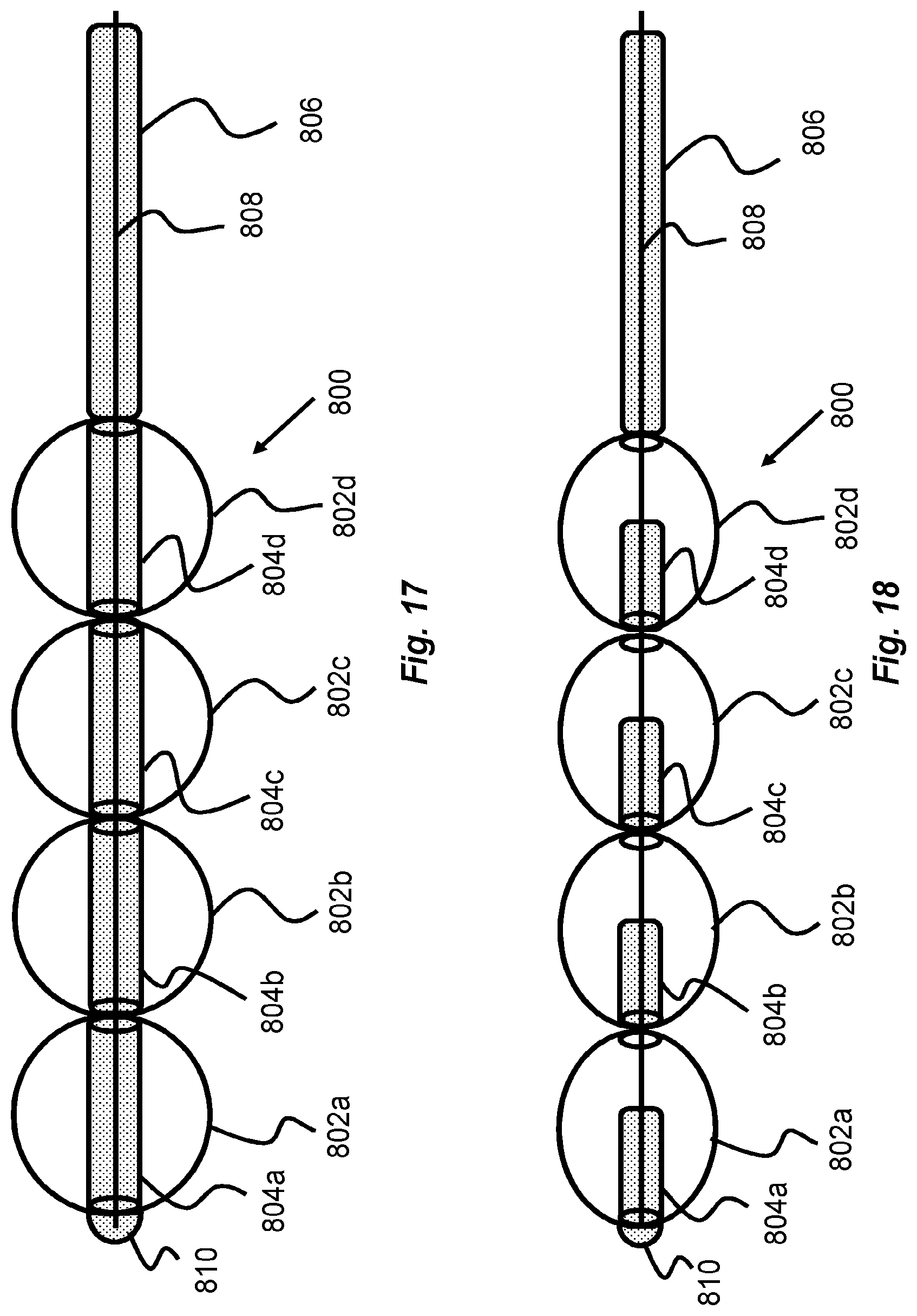 Patent US12318103 Figure 12 – Obstruction removal system