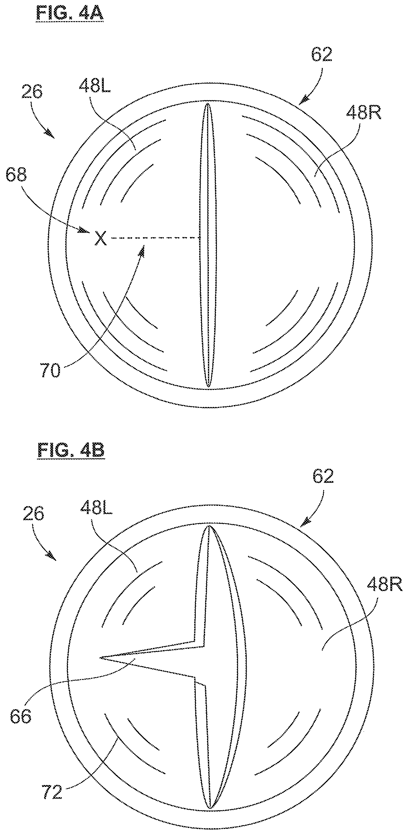 Patent US12318105 Figure 3 – Biscuspid valve dissection device