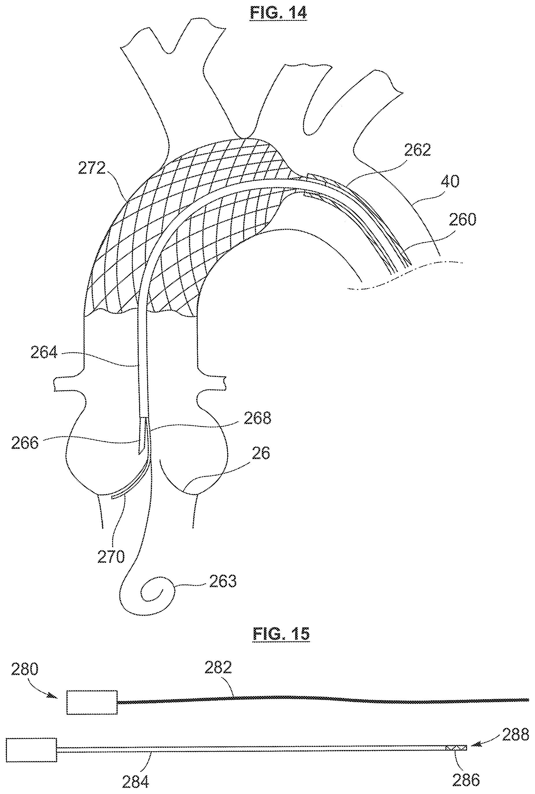 Patent US12318105 Figure 11 – Biscuspid valve dissection device