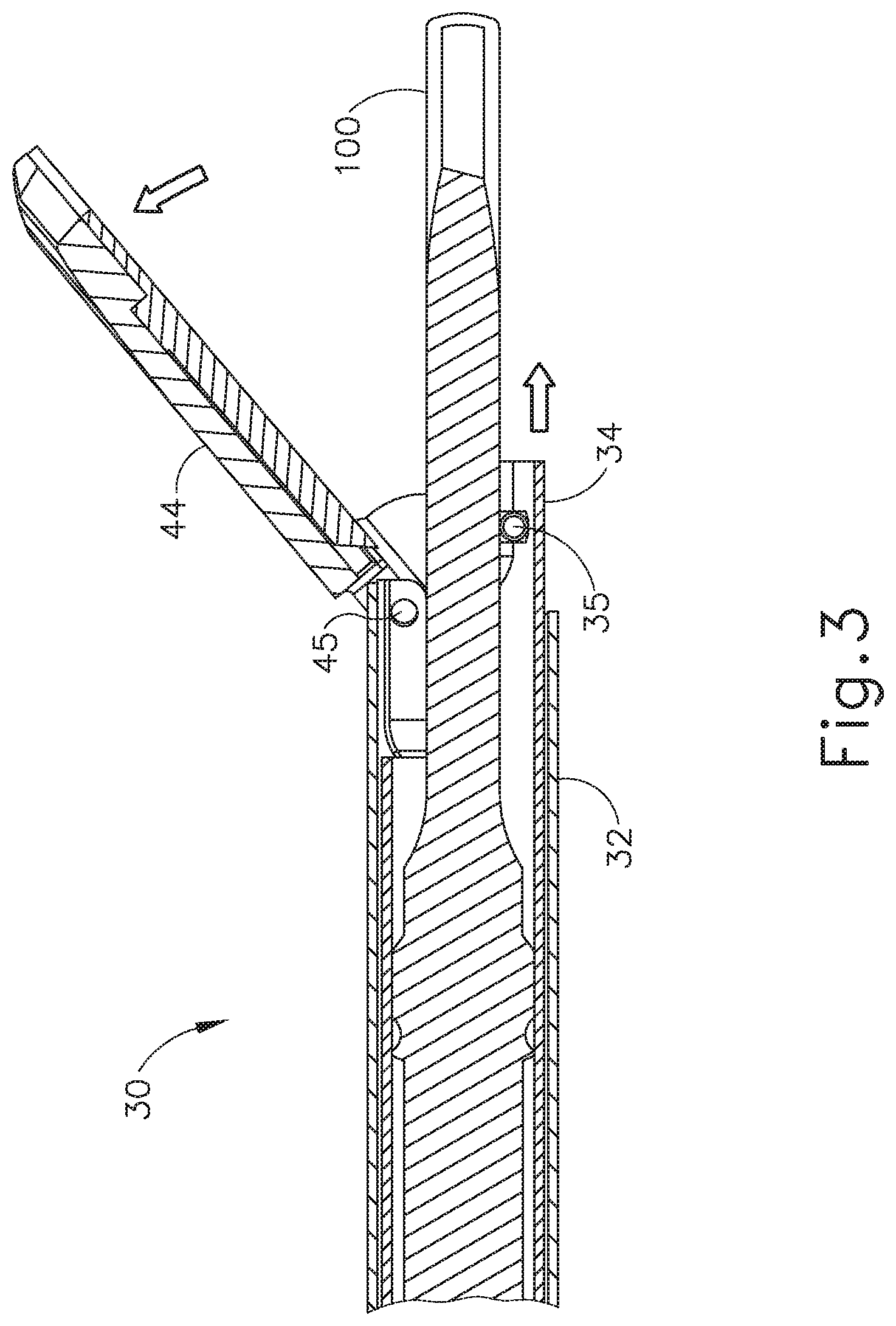 Patent US12318107 Figure 3 – Handpiece and blade configurations for ultrasonic surgical instrument