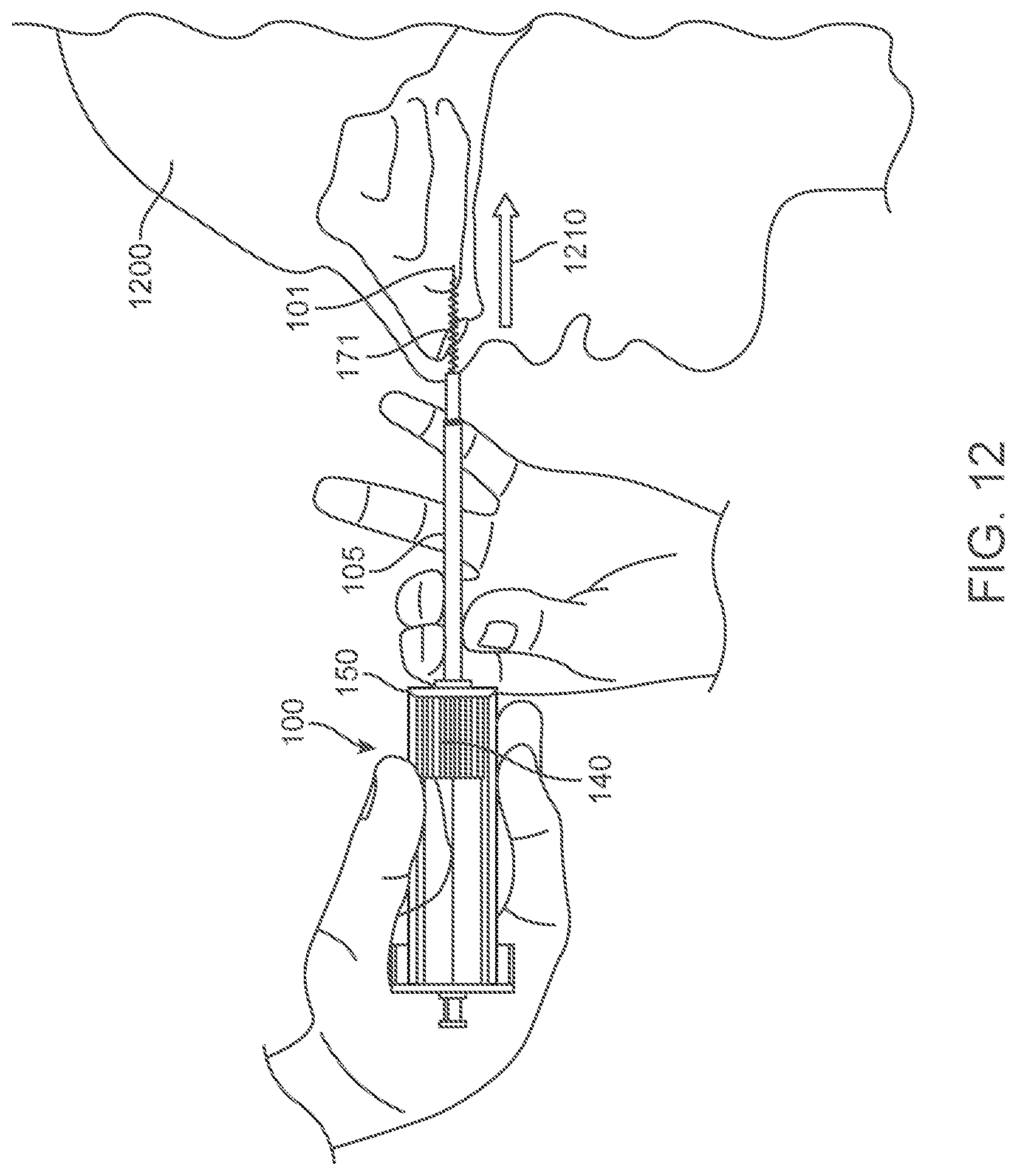 Patent US12318109 Figure 12 – Apparatus and methods for tissue reduction