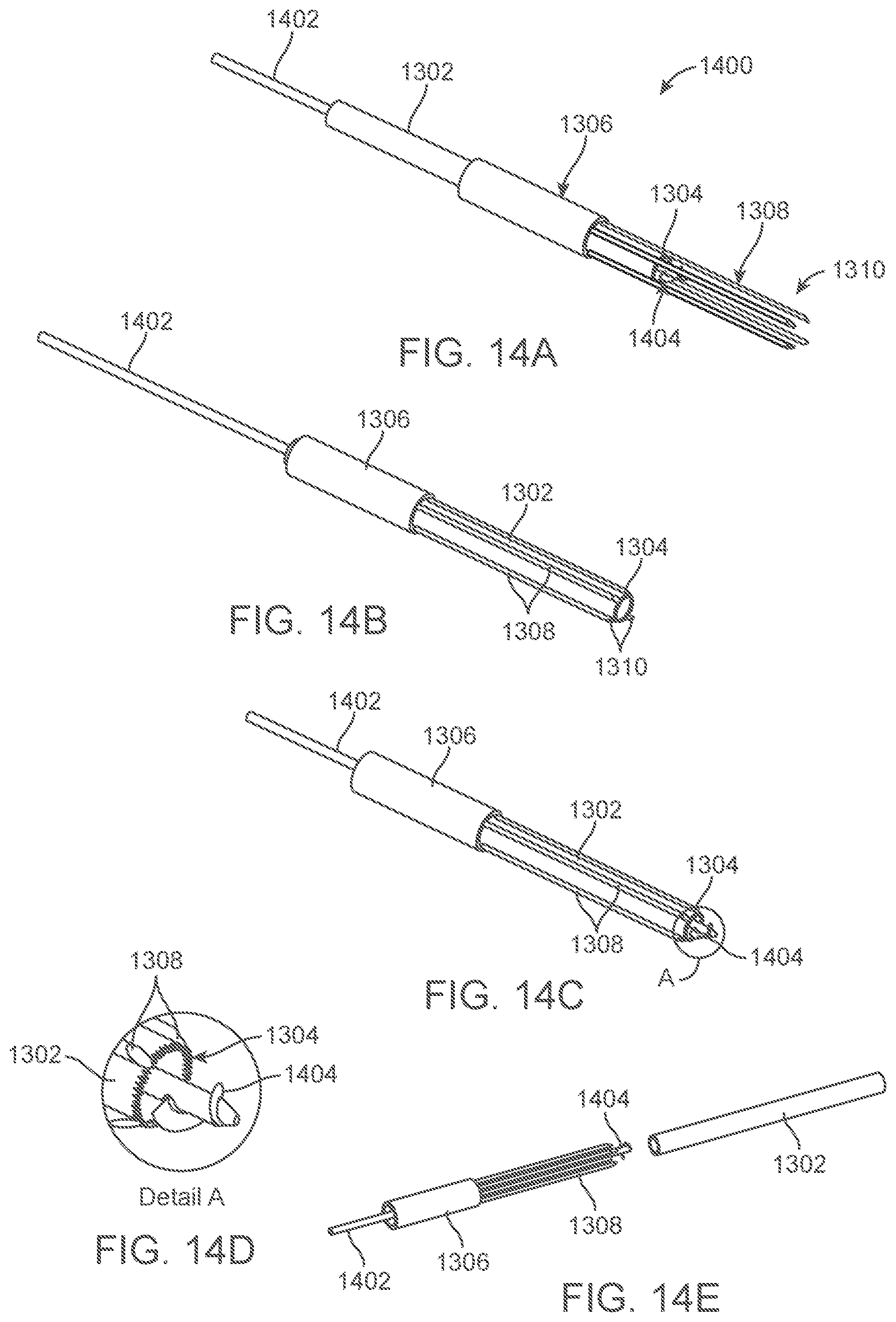 Patent US12318109 Figure 14 – Apparatus and methods for tissue reduction
