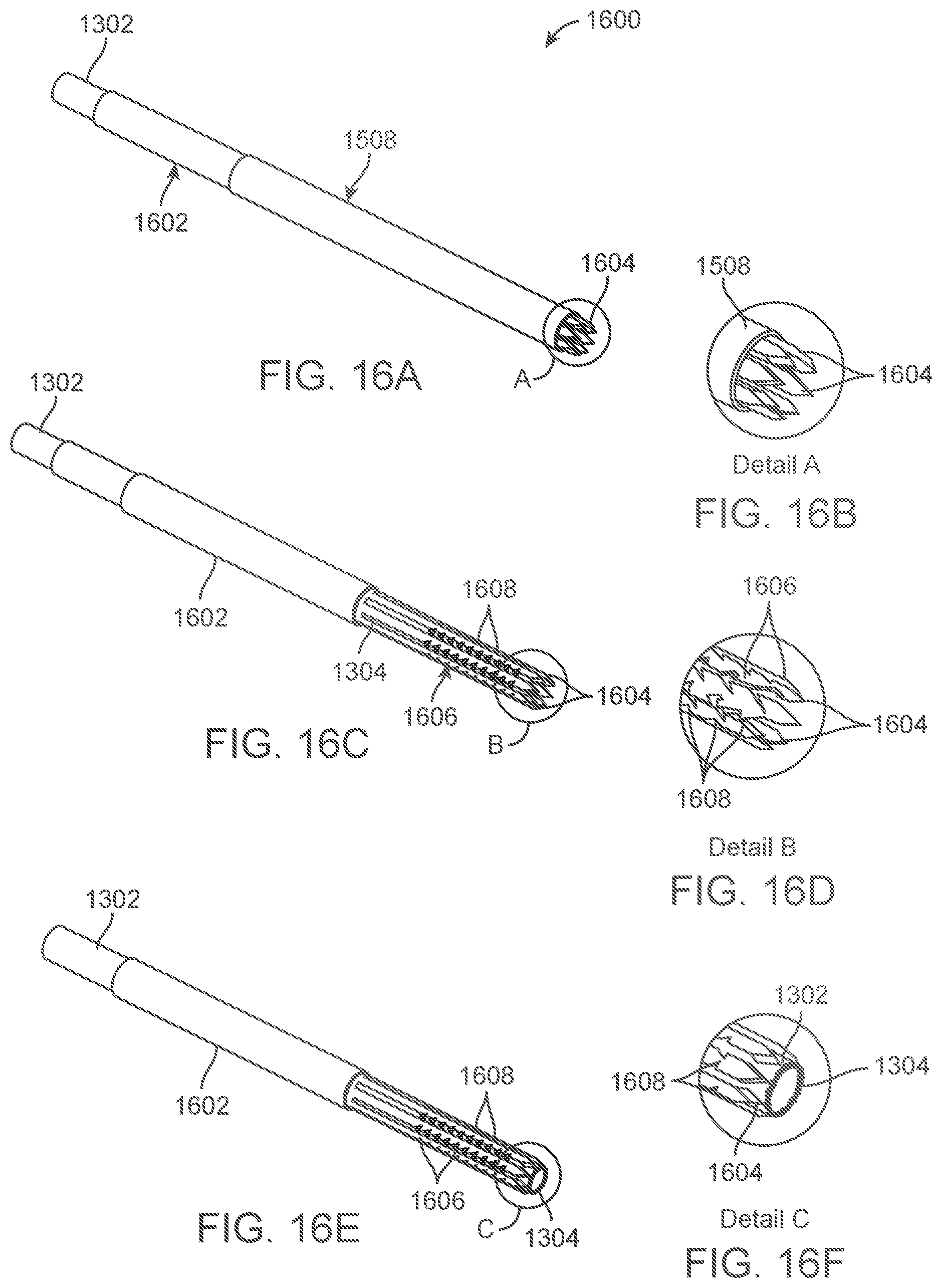 Patent US12318109 Figure 16 – Apparatus and methods for tissue reduction