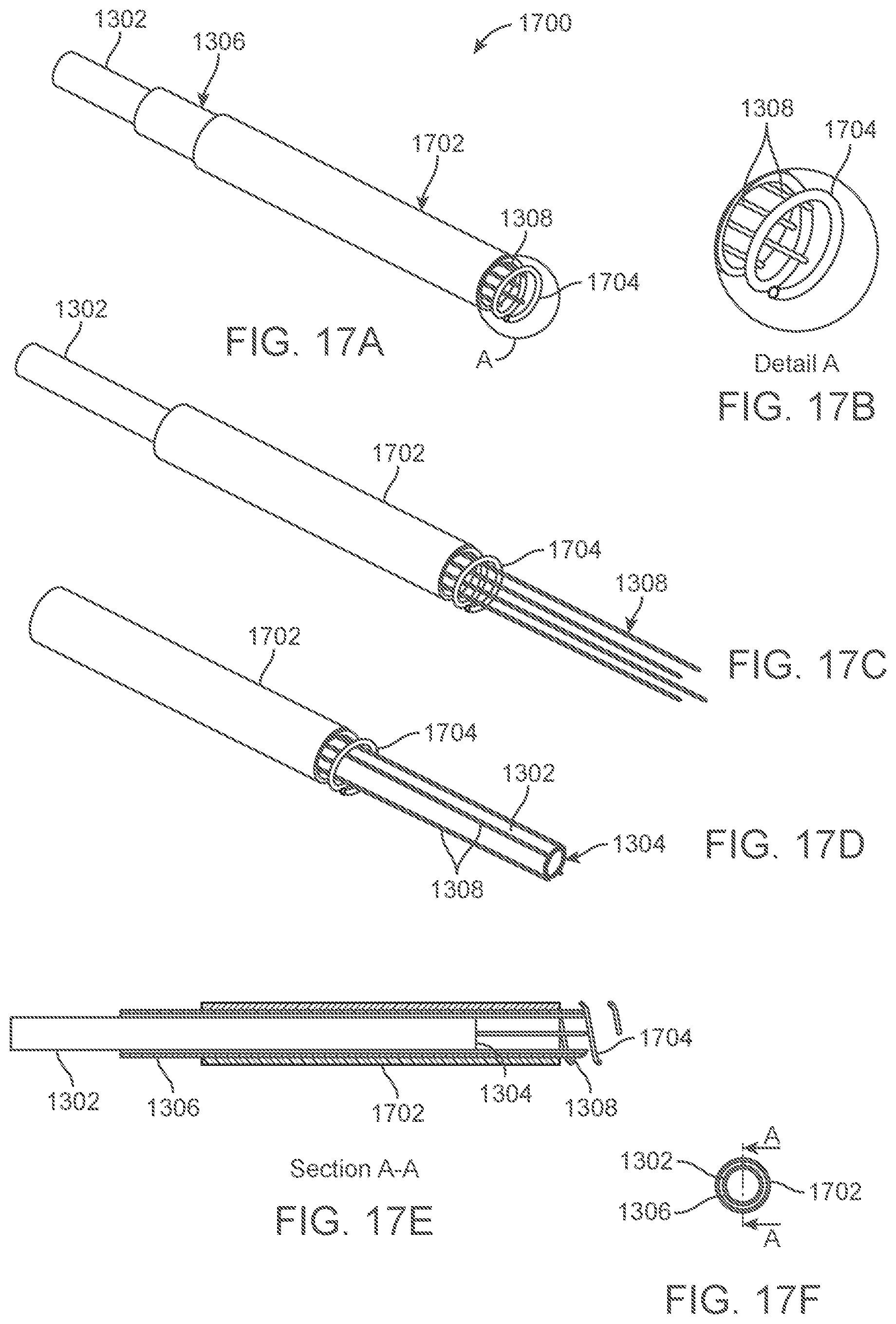 Patent US12318109 Figure 17 – Apparatus and methods for tissue reduction