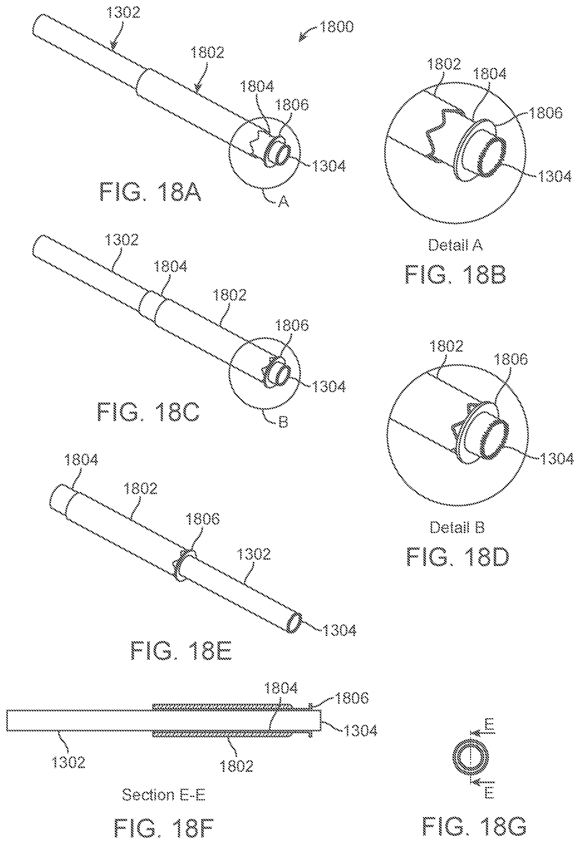 Patent US12318109 Figure 18 – Apparatus and methods for tissue reduction