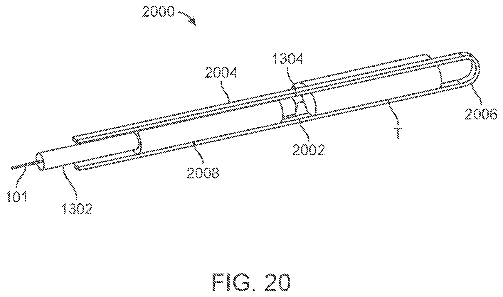 Patent US12318109 Figure 20 – Apparatus and methods for tissue reduction