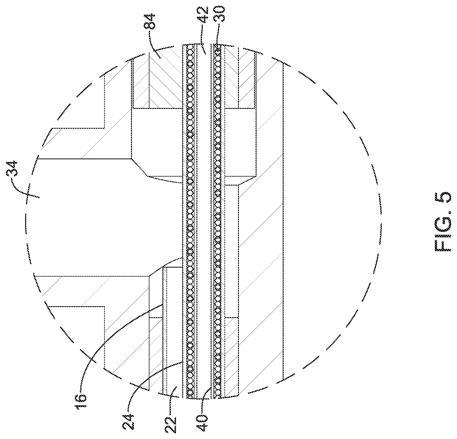 Patent US12318111 Figure 5 – Infusion lubricated atherectomy catheter