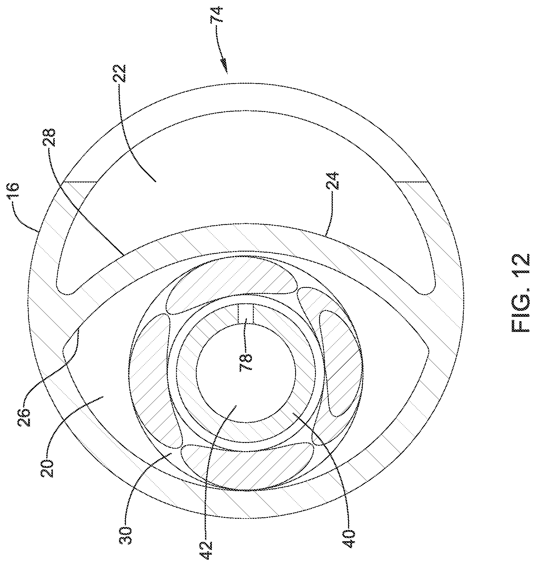 Patent US12318111 Figure 12 – Infusion lubricated atherectomy catheter