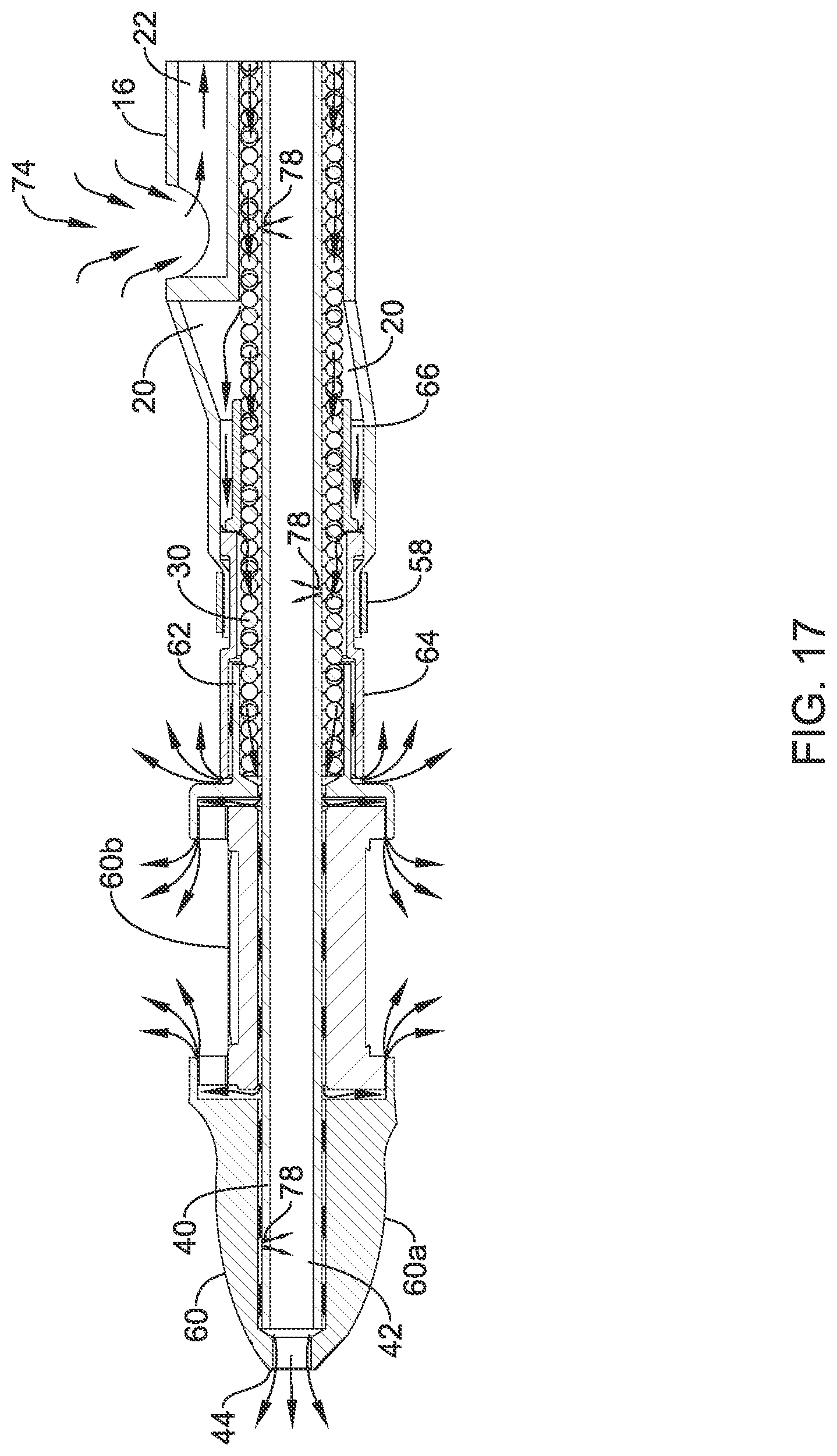 Patent US12318111 Figure 17 – Infusion lubricated atherectomy catheter