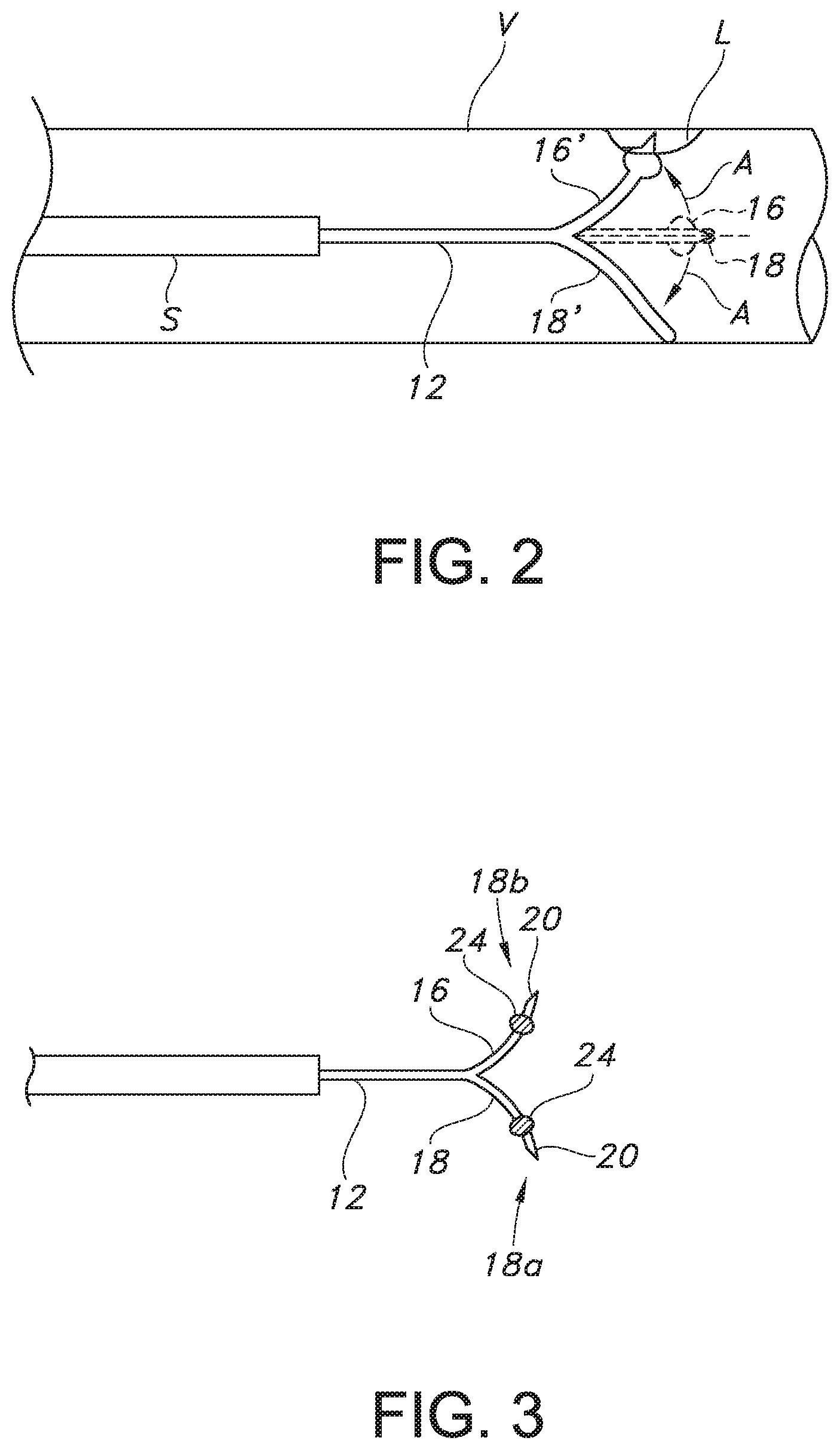 Patent US12318112 Figure 2 – Endovascular cutting apparatus