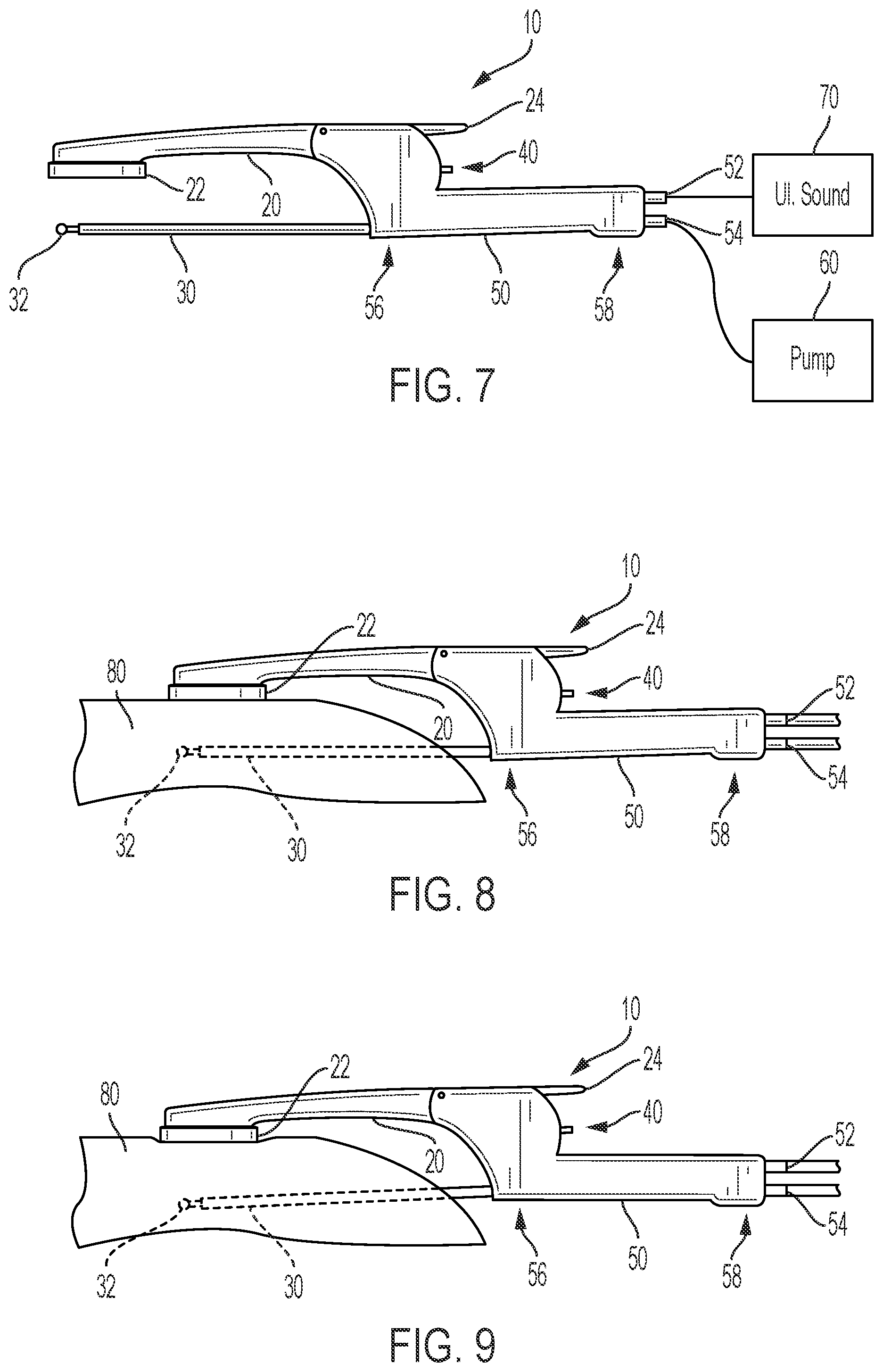 Patent US12318115 Figure 3 – Combination ultrasound transducer and fat injecting cannula