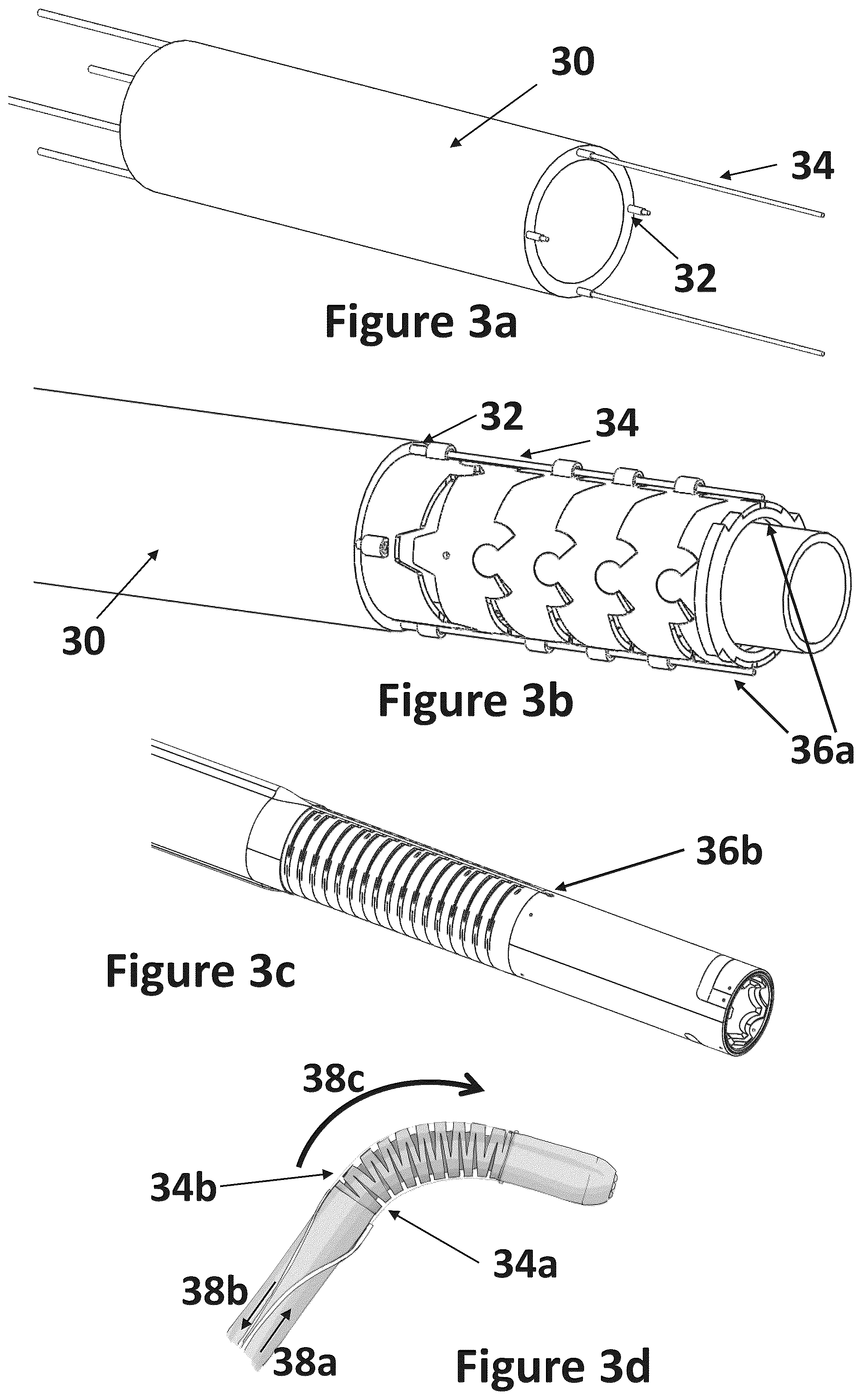 Patent US12318116 Figure 4 – Cardiac lead extraction device