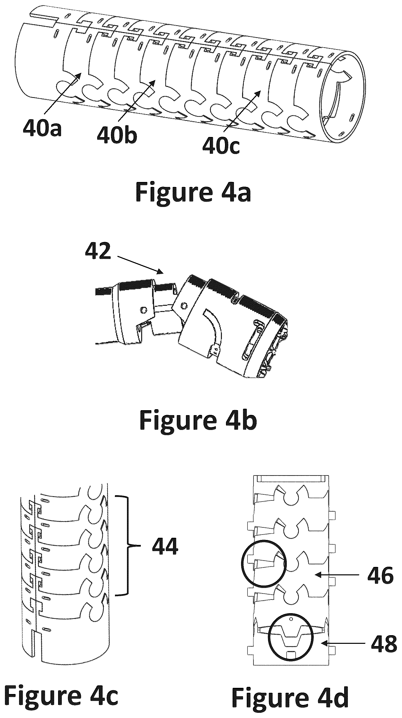 Patent US12318116 Figure 6 – Cardiac lead extraction device