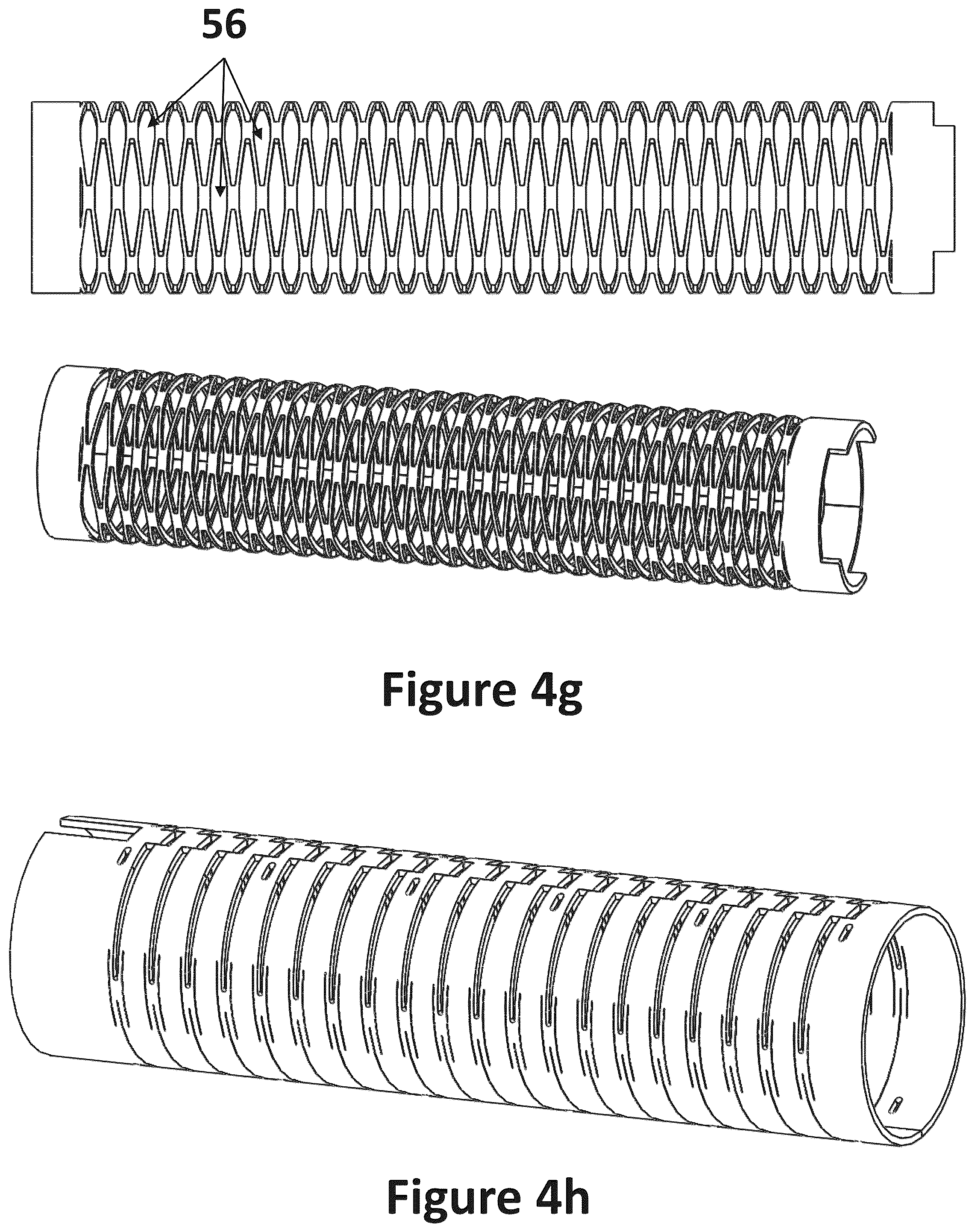 Patent US12318116 Figure 8 – Cardiac lead extraction device