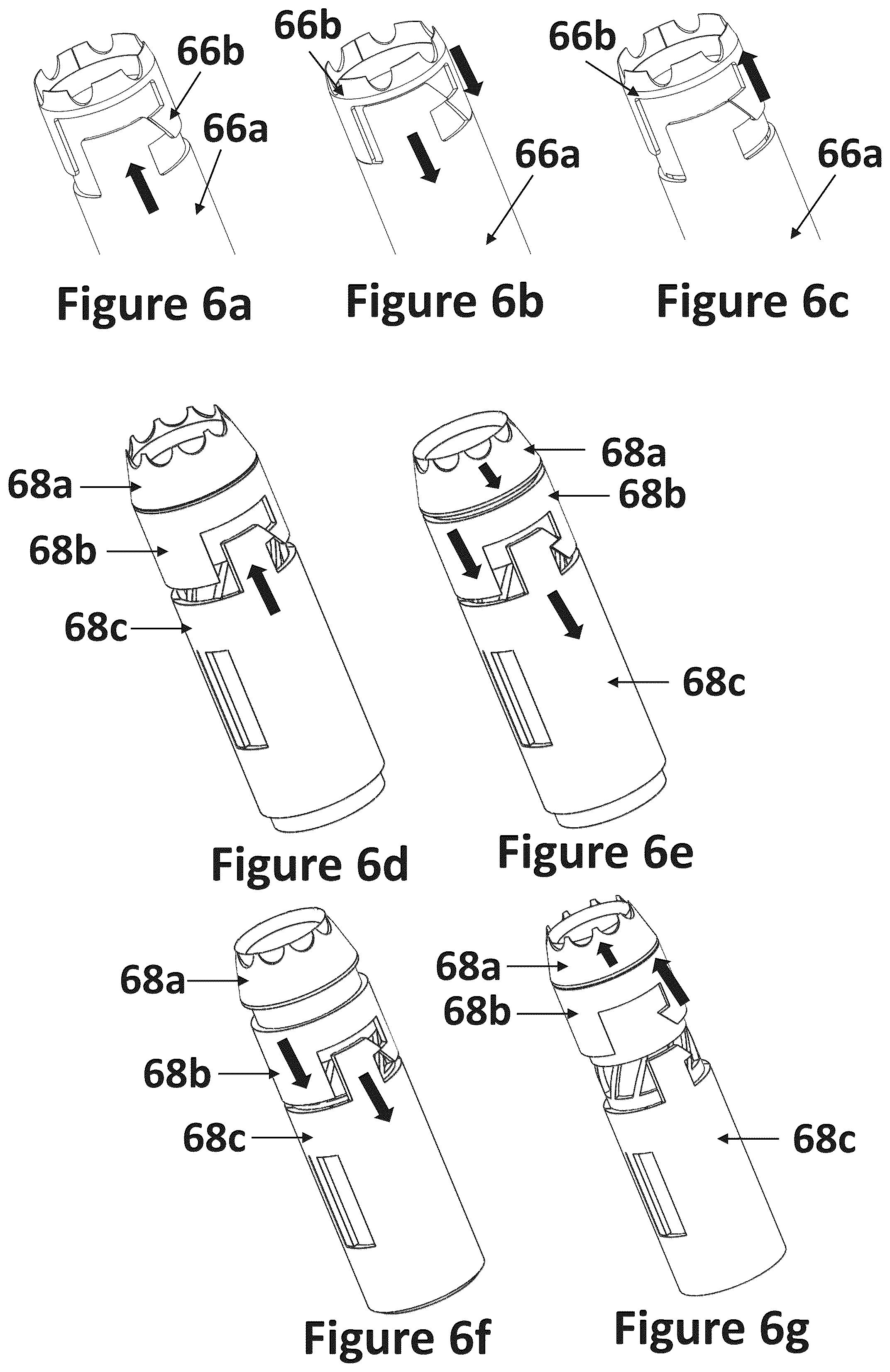 Patent US12318116 Figure 11 – Cardiac lead extraction device