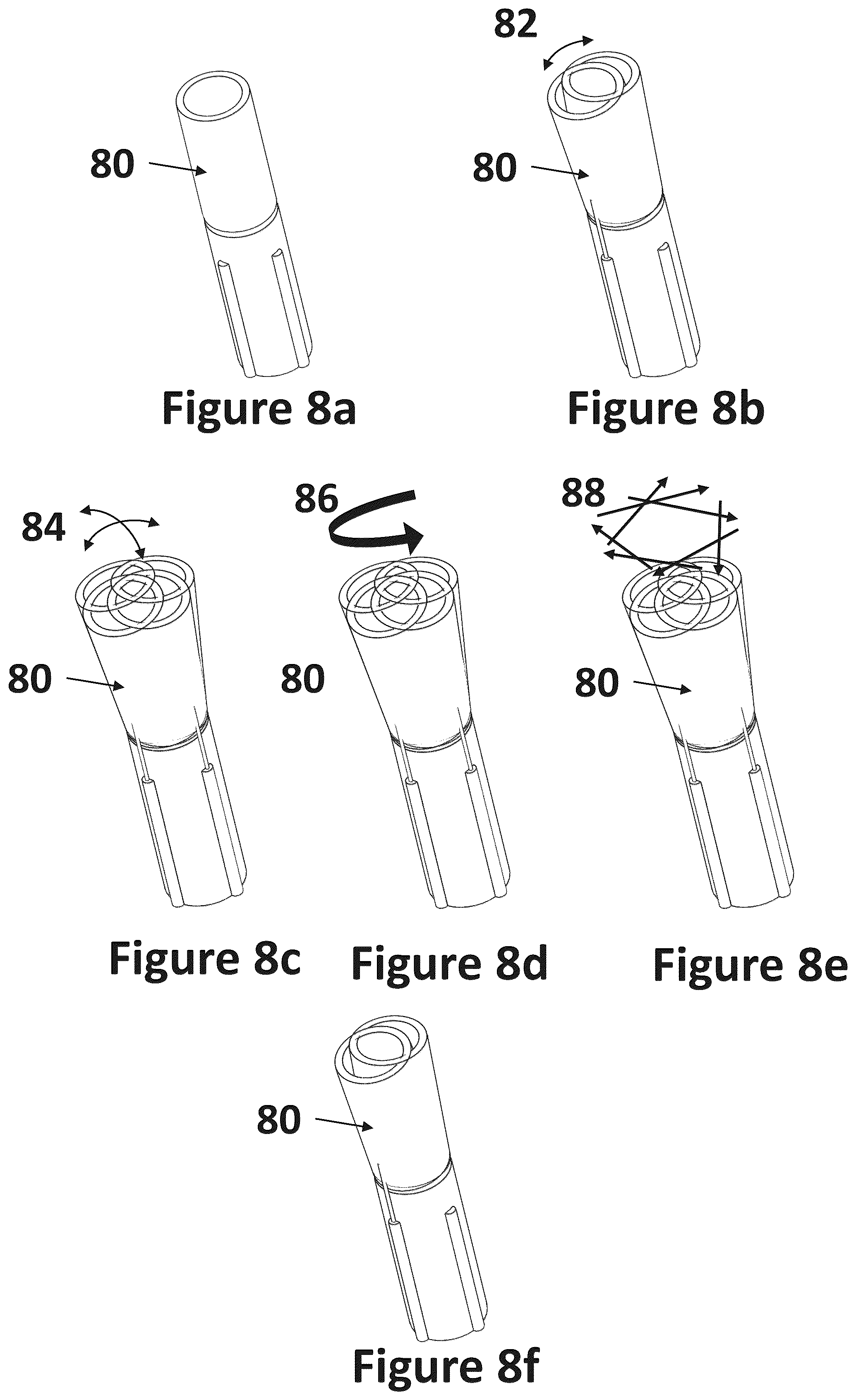 Patent US12318116 Figure 13 – Cardiac lead extraction device