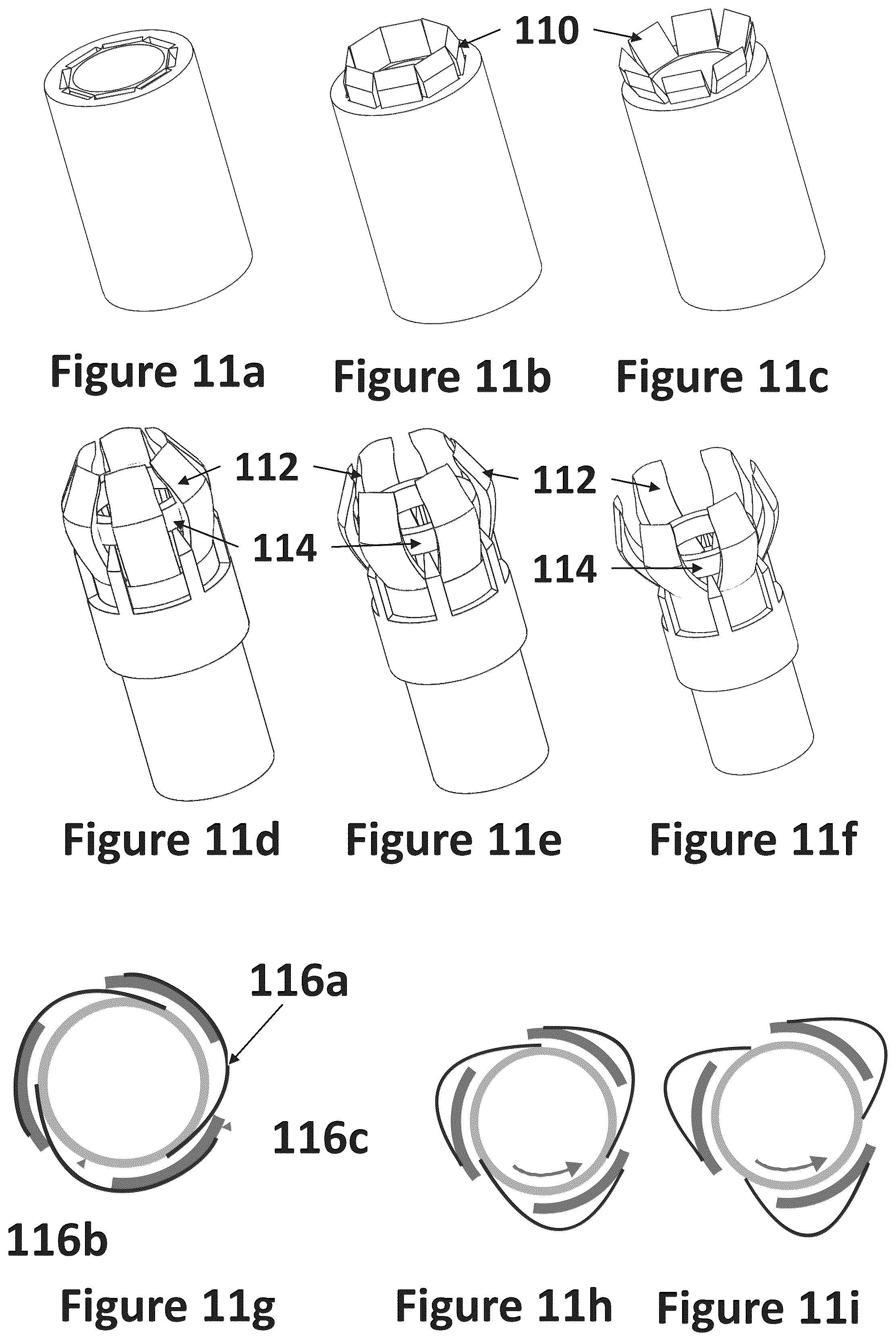 Patent US12318116 Figure 16 – Cardiac lead extraction device